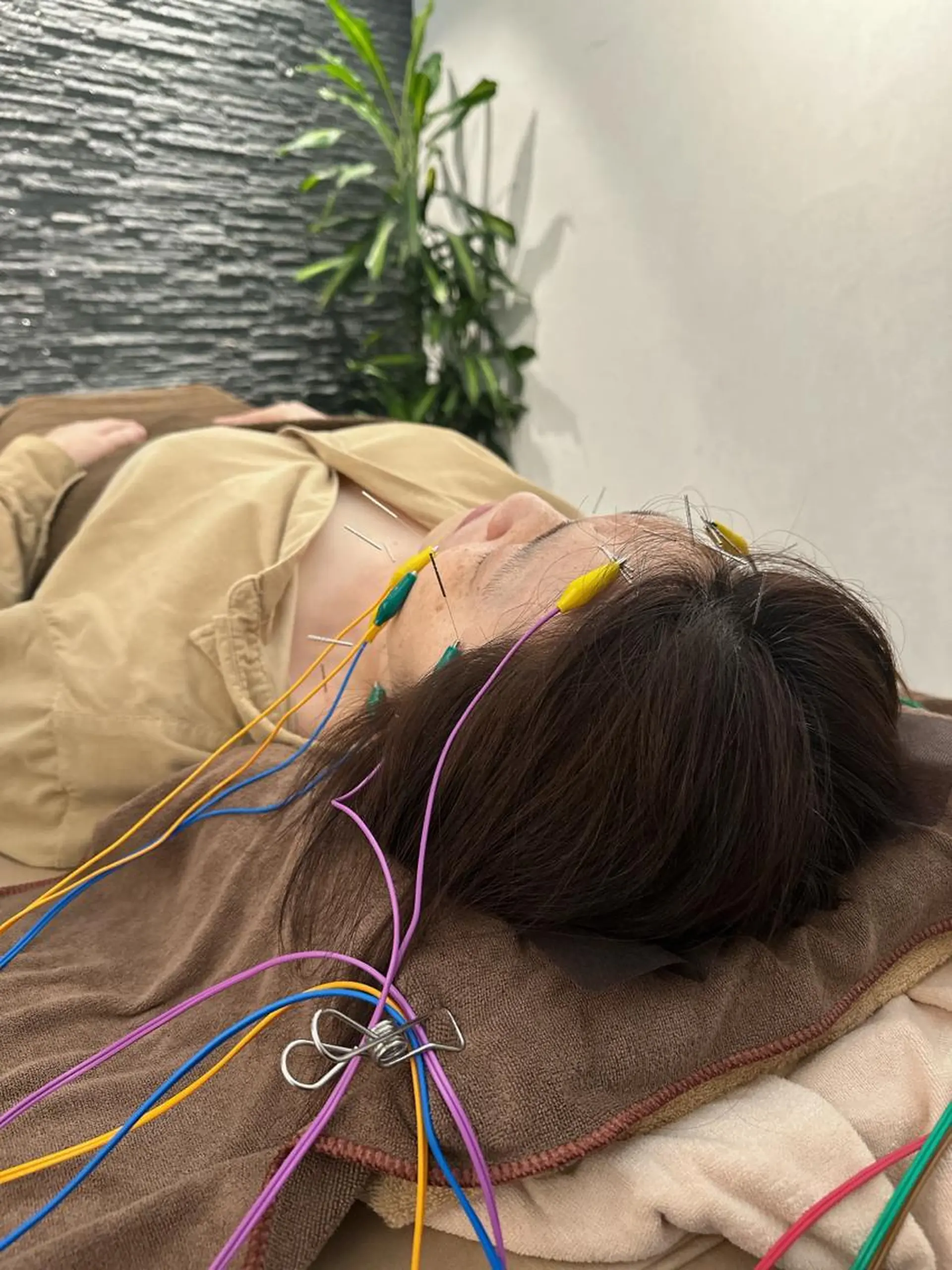 その他 美容鍼灸整体サロンBeauJu所属・小顔矯/美容鍼/鍼灸 BeauJuのその他イメージ