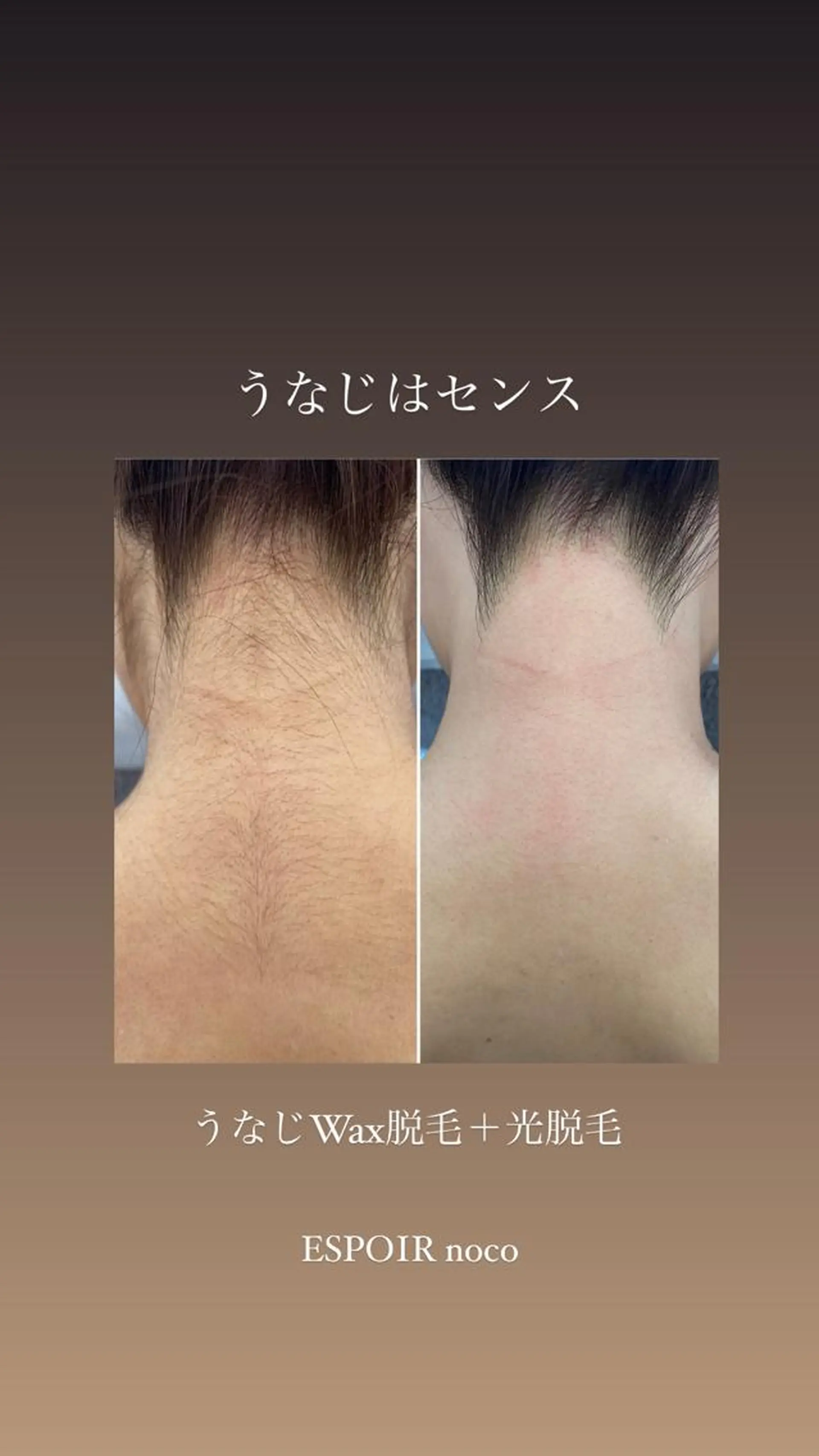 ヘアアレンジ アイブロウ 眉毛ワックス脱毛 ワックス脱毛🌈 ESPOIRnocoのエステ・リラクイメージ