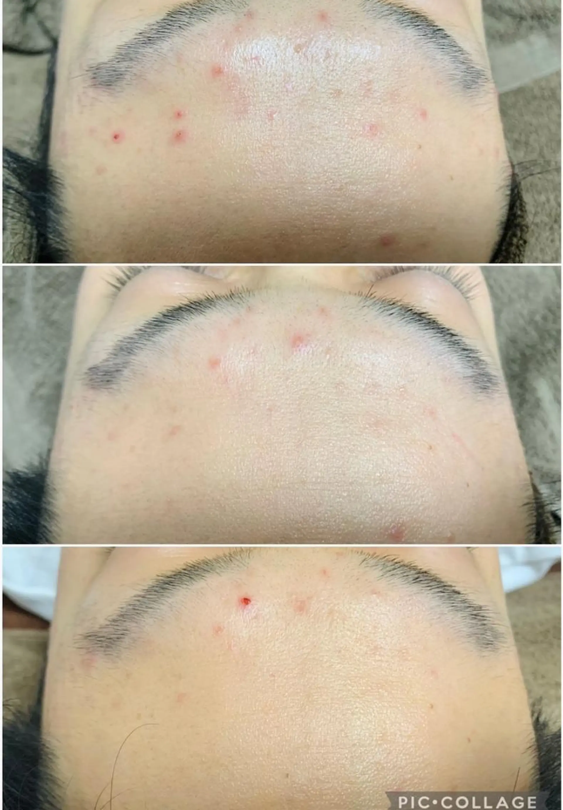 ロング カラー パーマ ヘアアレンジ メンズ キッズ ネイル マツエク・マツパ アイブロウ 肌質体質を変えて すっぴん肌にのエステ・リラクイメージ