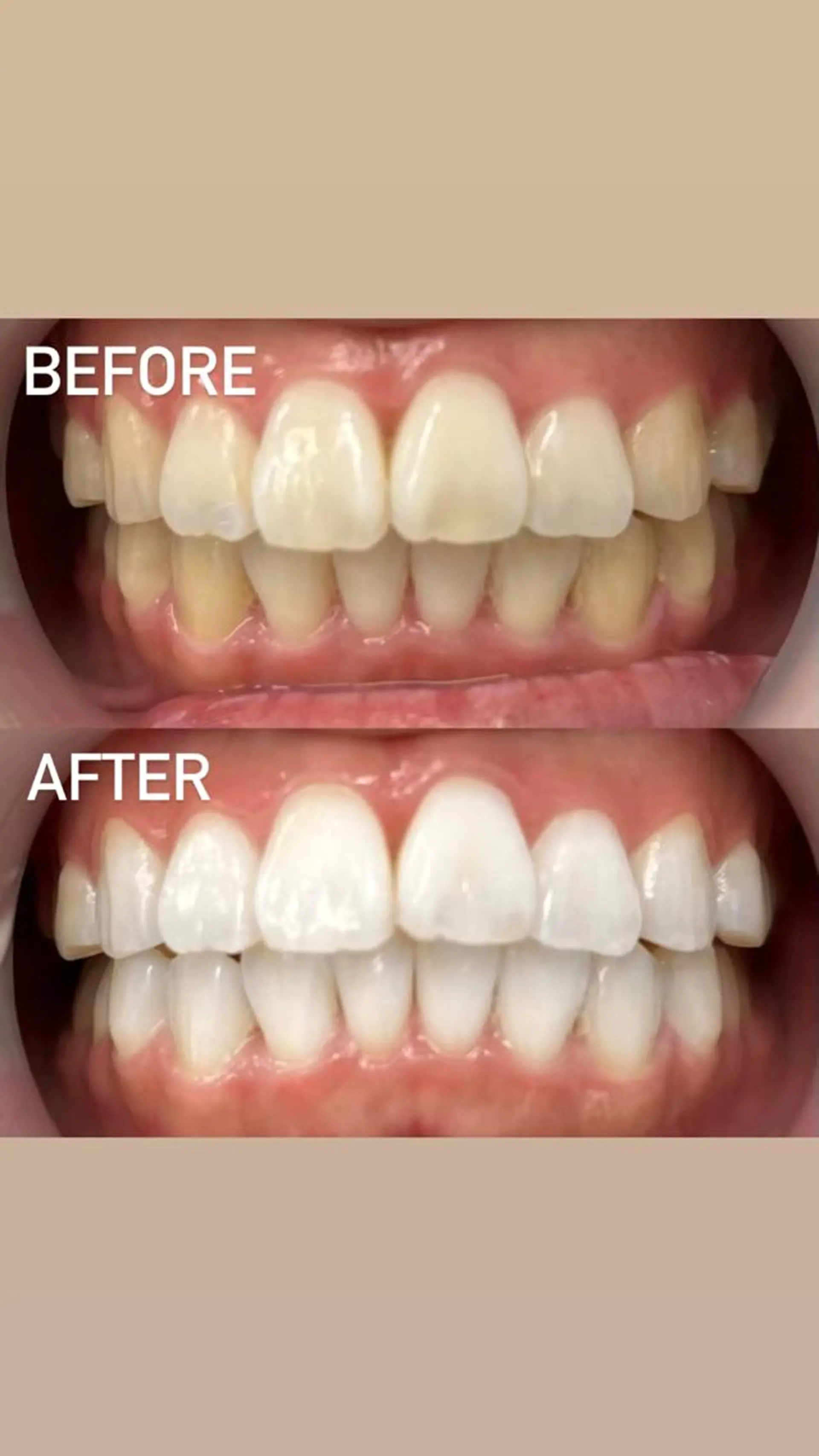 エステ リラク LBSホワイトニング 銀座店💎店長浦和のその他イメージ