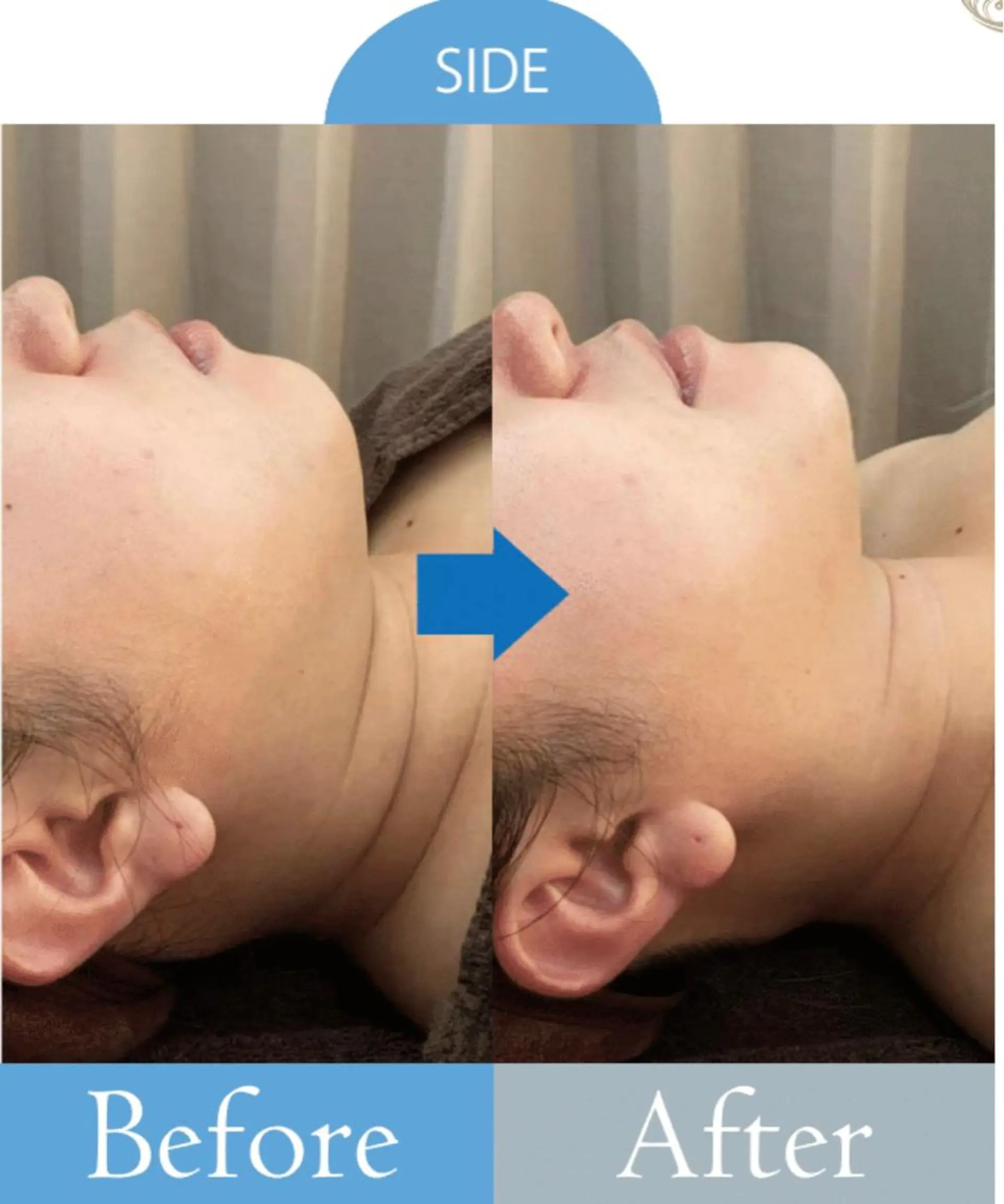 美肌/小顔/眉毛の 専門店 ルミナスのマツエク・マツパデザイン