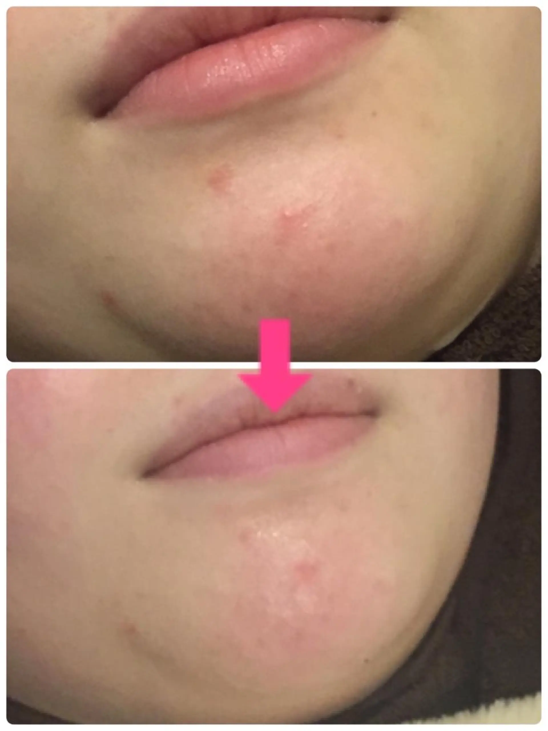 カラー パーマ ヘアアレンジ メンズ キッズ ネイル マツエク・マツパ ‍痩身＆ボディ 結果出し🌟丹野のエステ・リラクイメージ