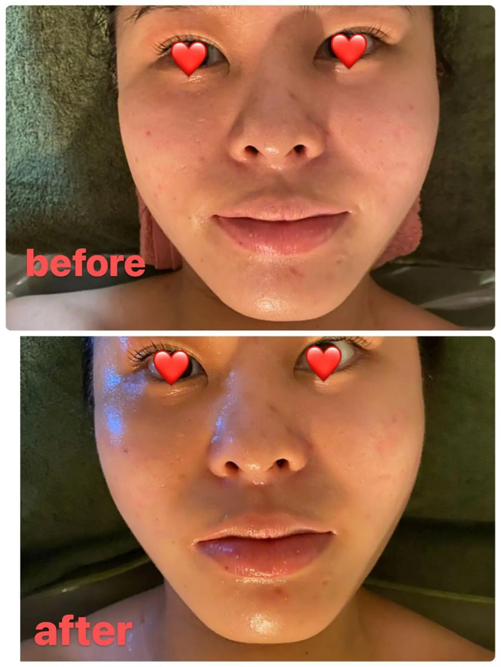 リラクゼーション ルナのエステ・リラクイメージ