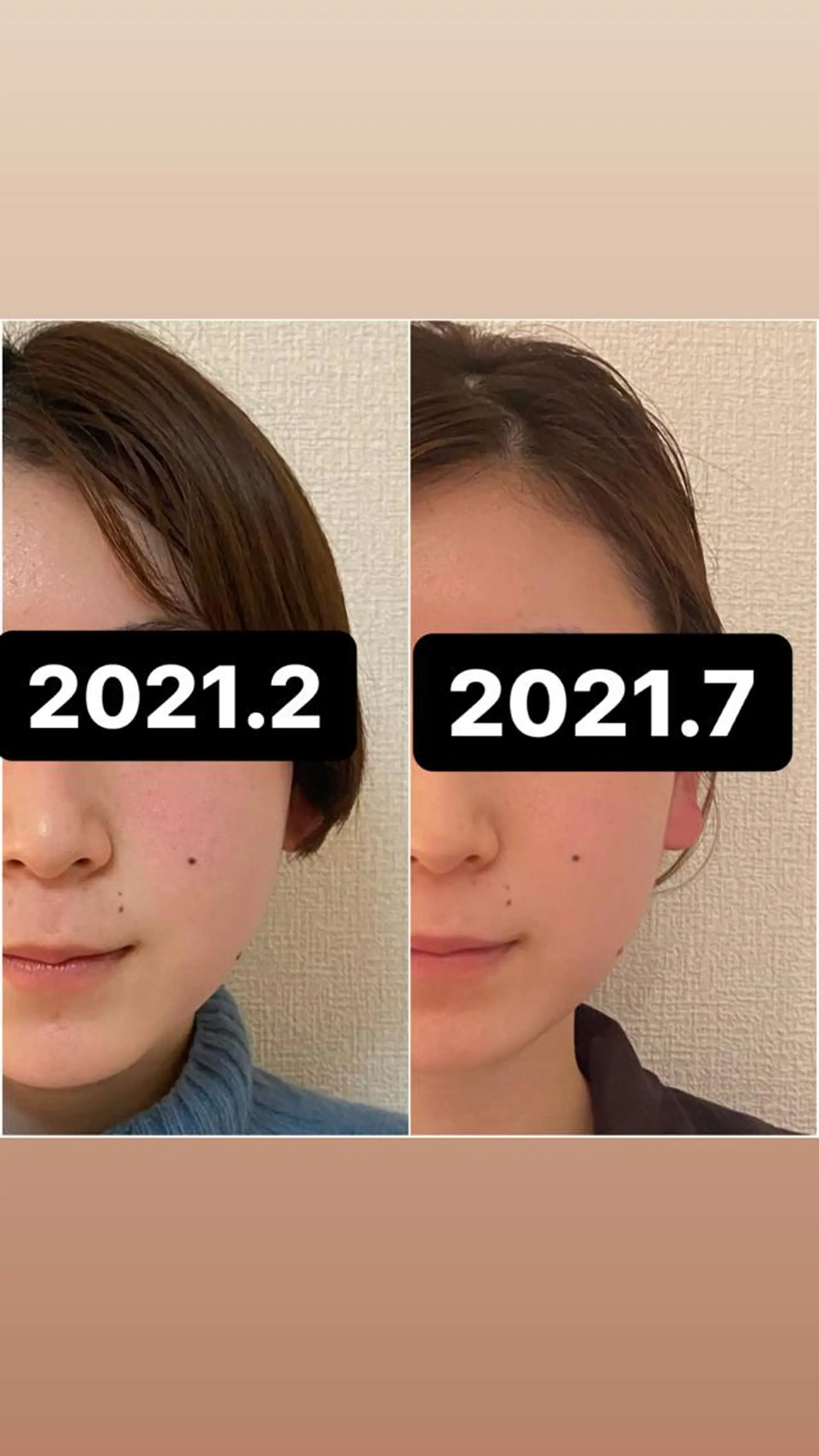 エステ リラク 美容鍼灸サロンRemeリミー所属・美容鍼WINBACK サロンRemeのエステ・リラクイメージ