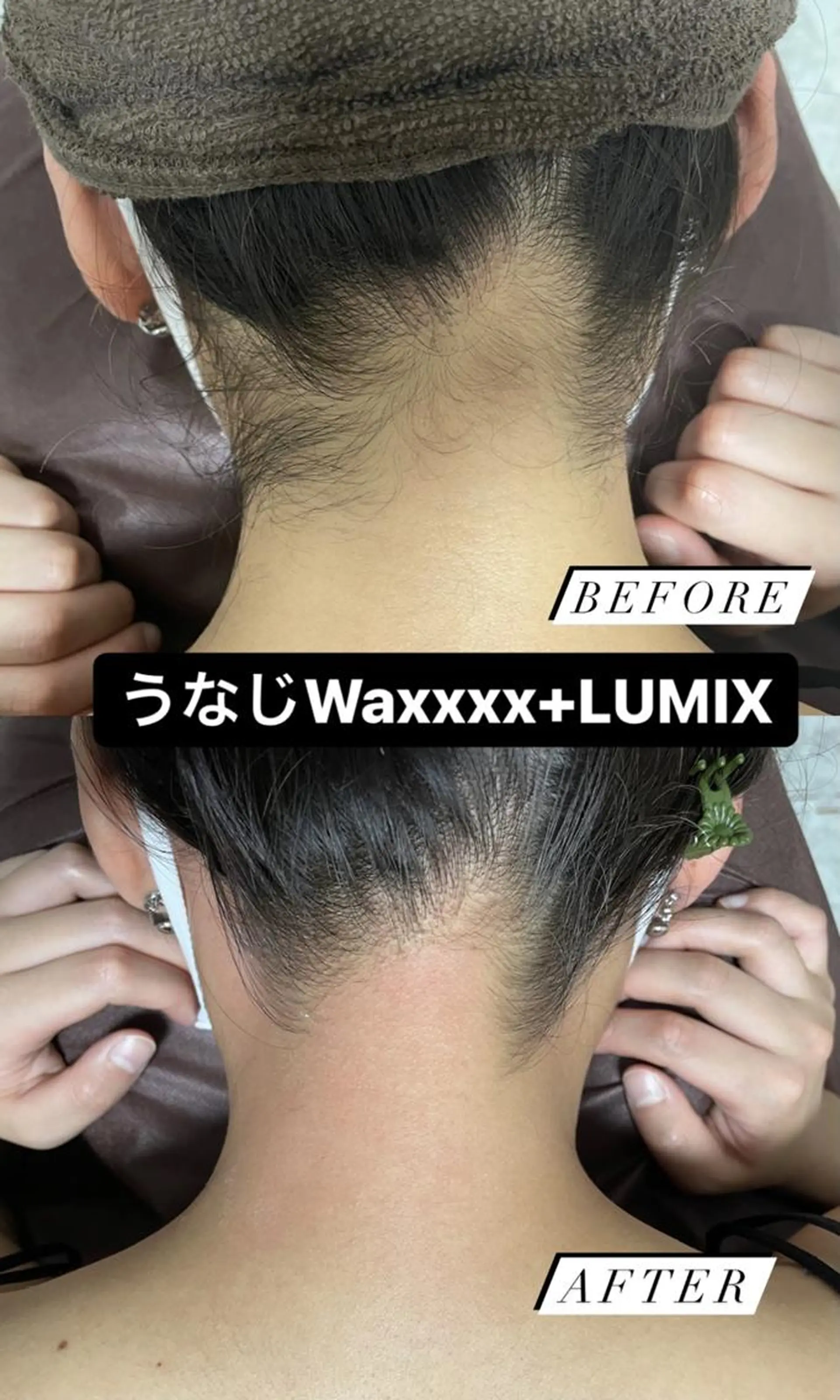 メンズ キッズ 脱毛 Epina 千葉店 【エピナ】のエステ・リラクイメージ