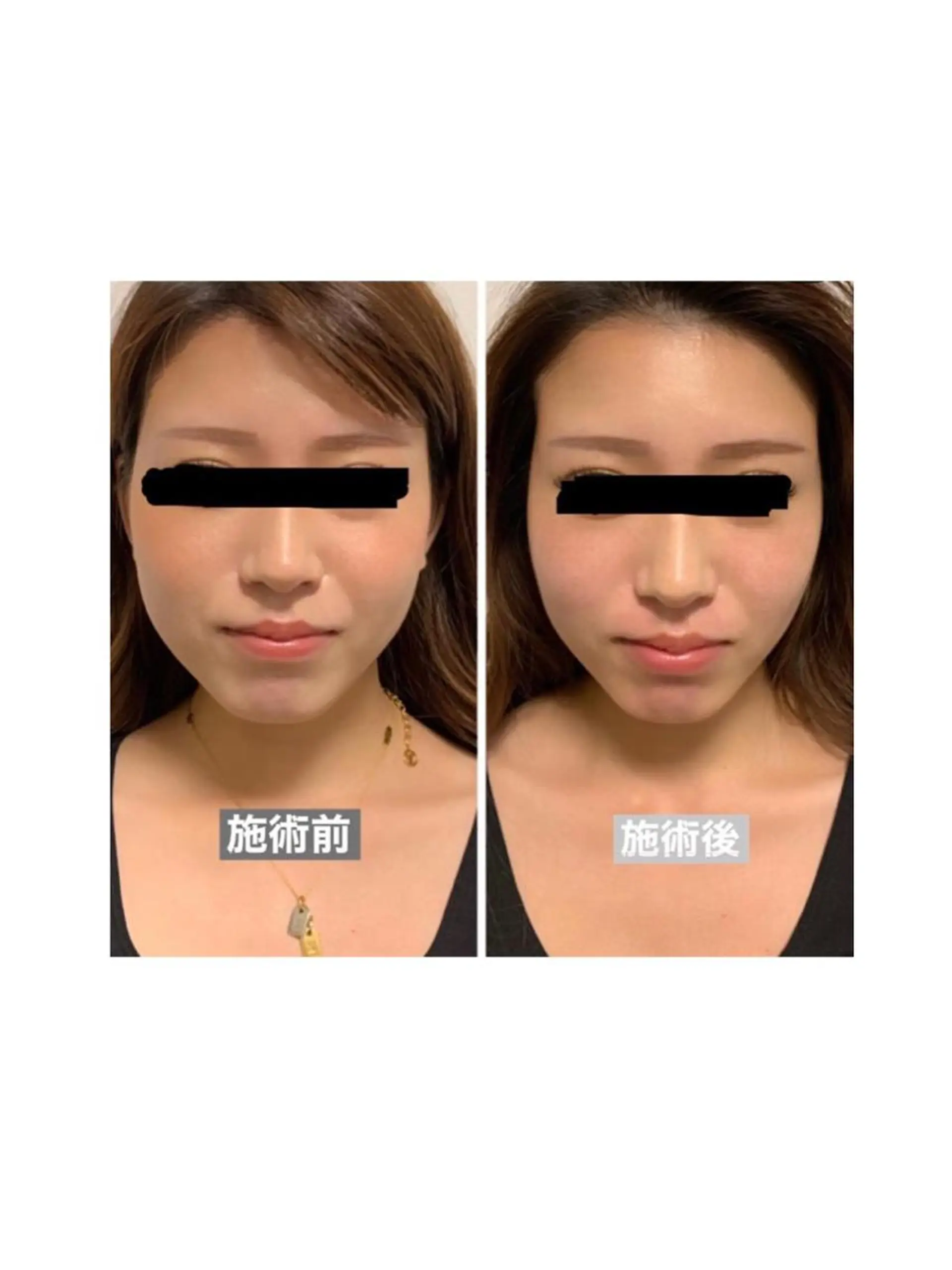 ハイフ・小顔・骨盤 シャングリラのエステ・リラクイメージ