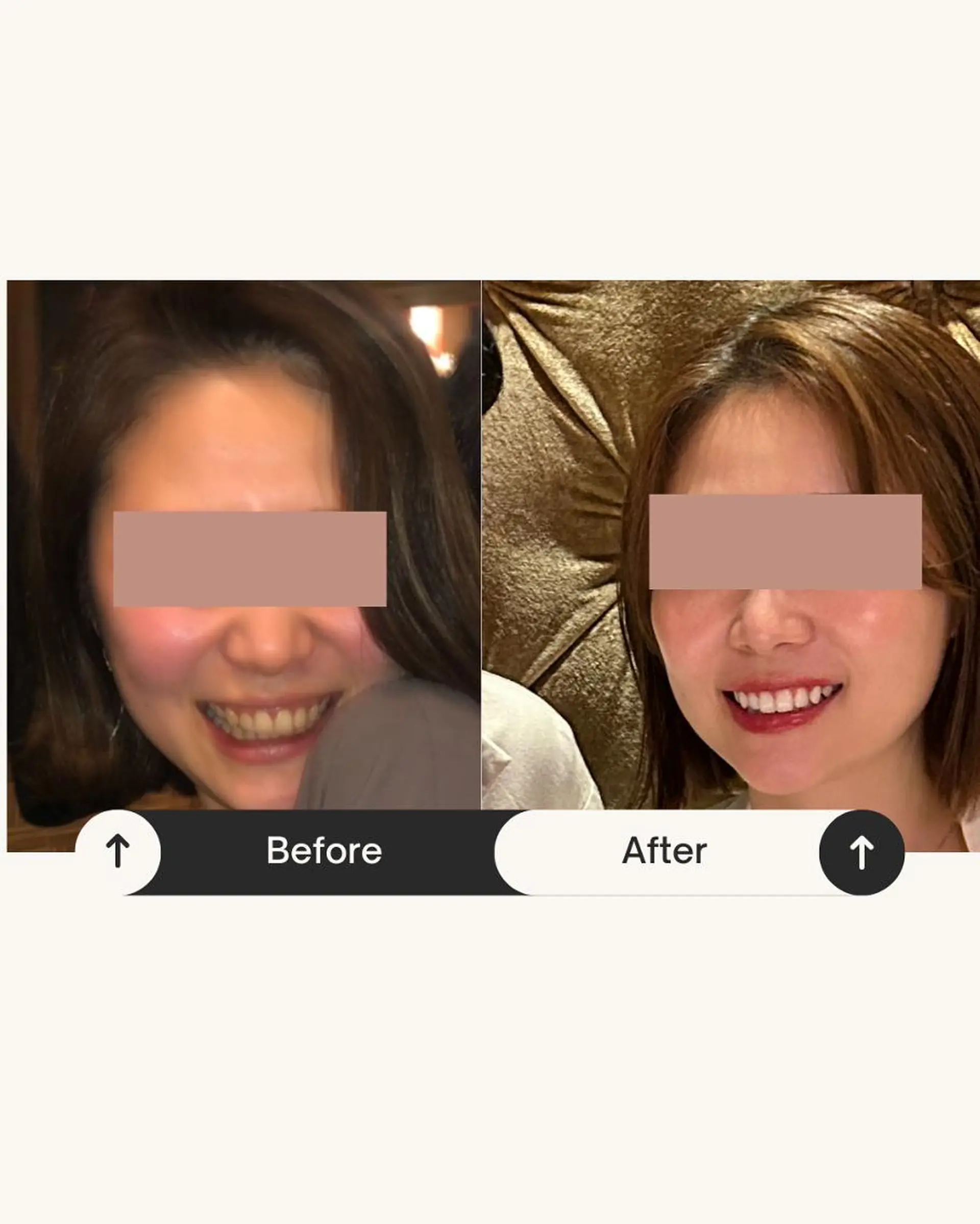 Whitening Carat 恵比寿店所属・ホワイトニング カラット 恵比寿店のエステ・リラクイメージ