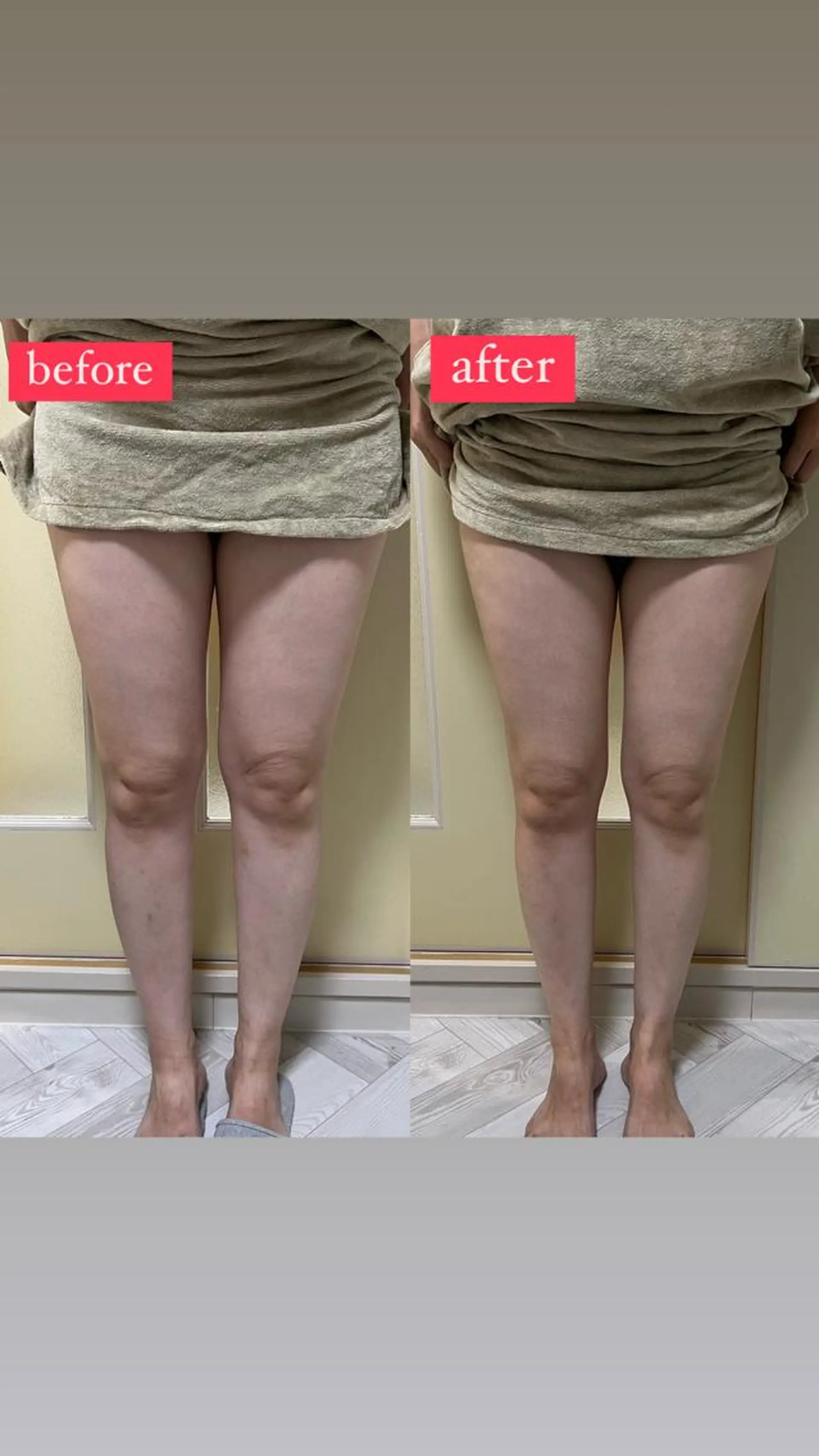 エステ VIOLUS所属・VIOLUS 関目のネイルデザイン