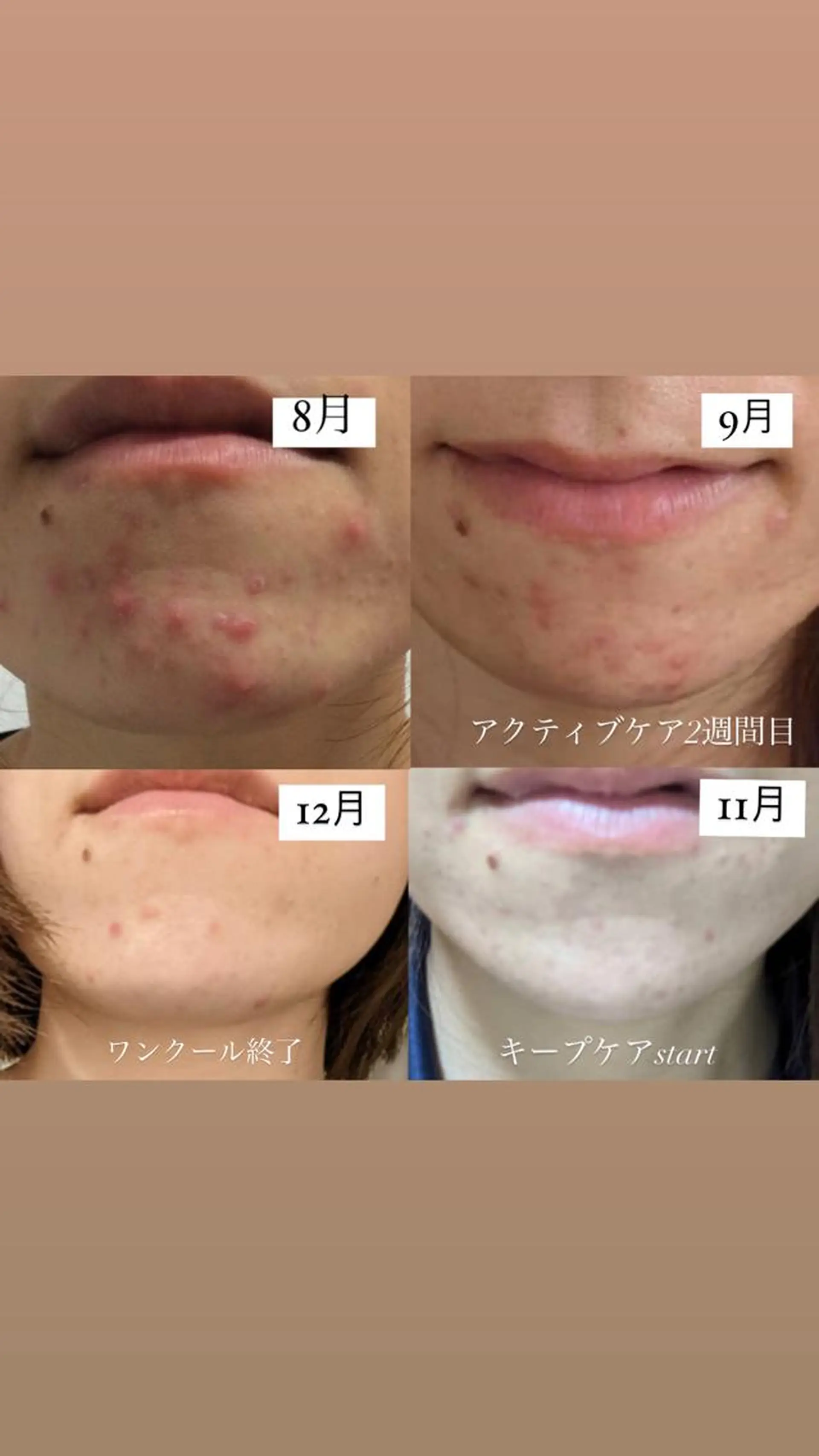 ALIA Scintiller  アリアサンティエ所属・齋藤 祐里耶のエステ・リラクイメージ