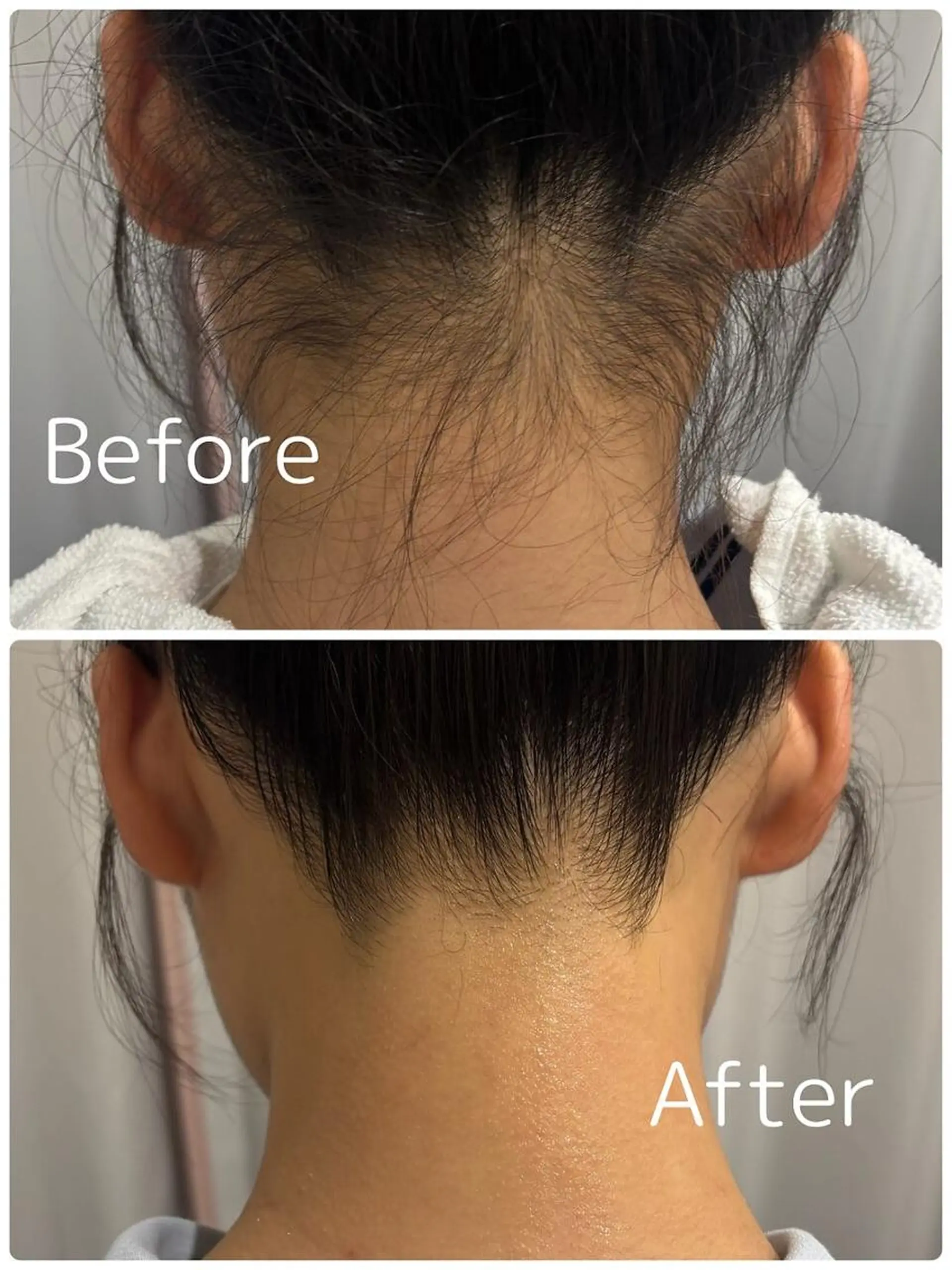 エステ リラク ビューティーフェイス トナリエ宇都宮店のエステ・リラクイメージ