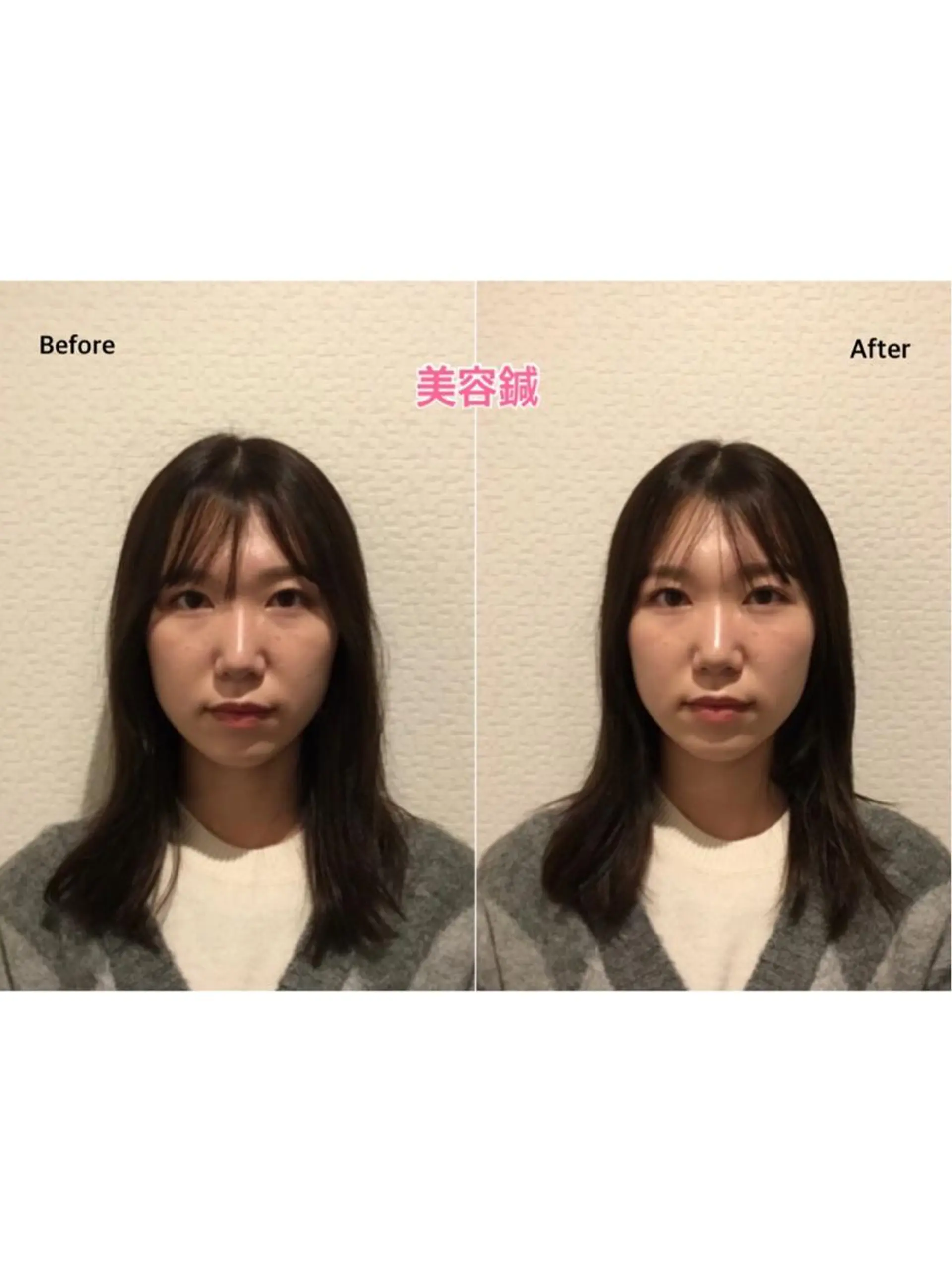 チキバン美容鍼灸整体 サロン心斎橋店のエステ・リラクイメージ