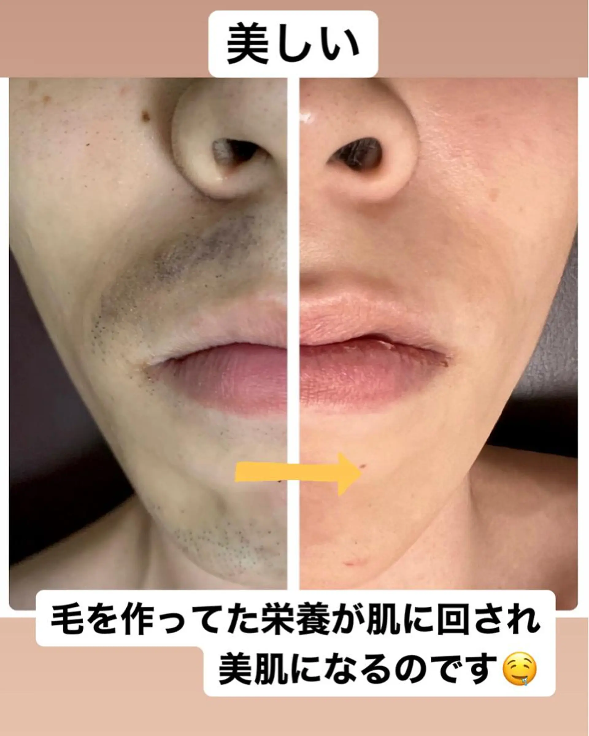 メンズ メンズハイライト メンズ脱毛サロン Le falcoのエステ・リラクイメージ