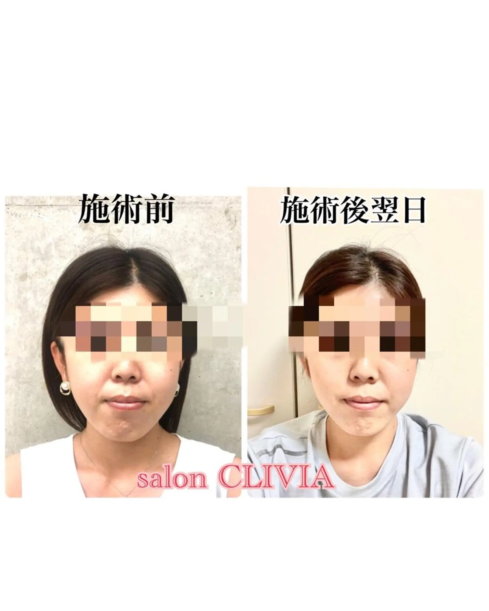 salon CLIVIA, クリヴィア所属・無痛小顔矯正 クリヴィアのエステ・リラクイメージ