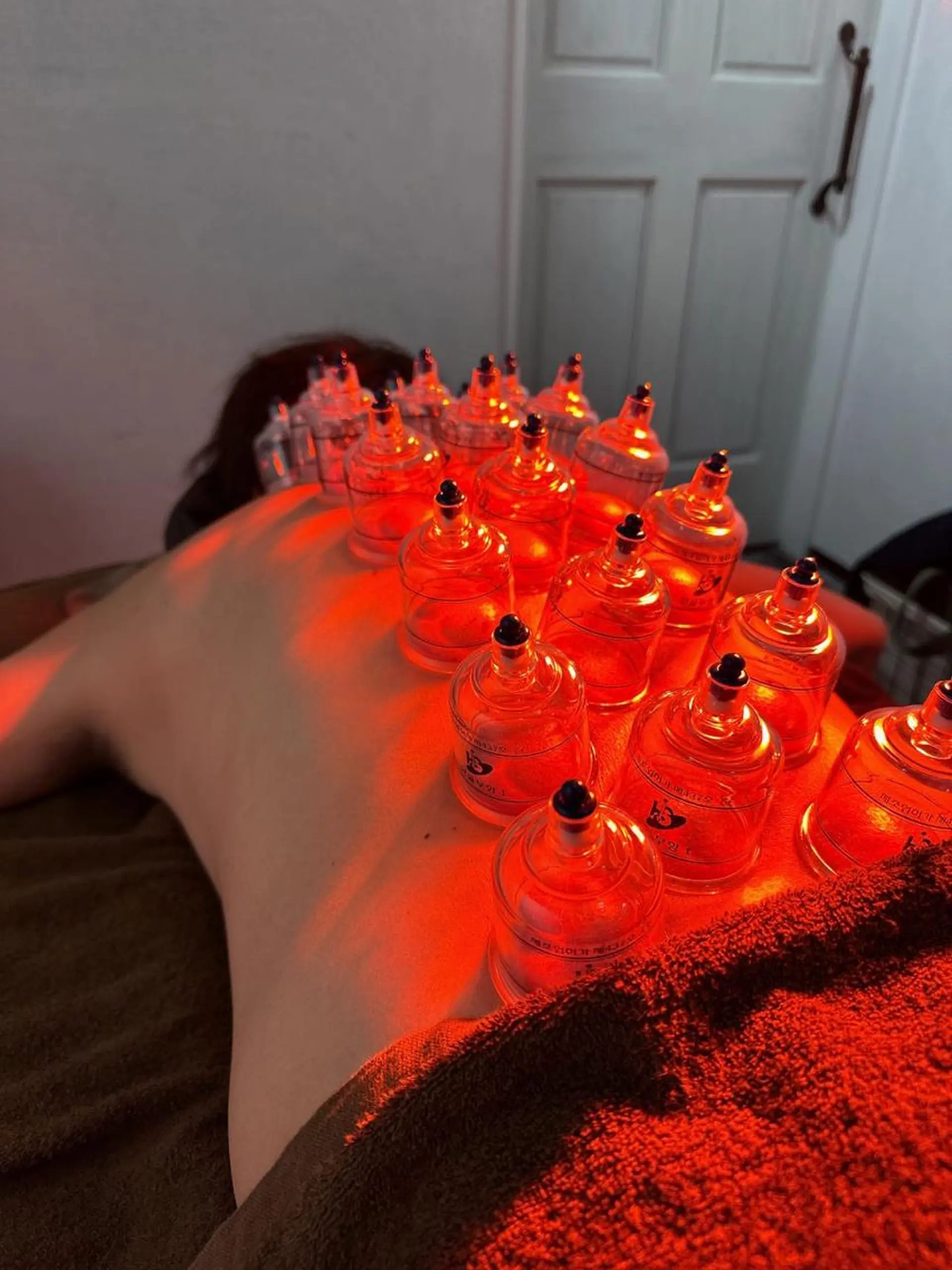 その他 美容鍼灸整体サロンBeauJu所属・小顔矯/美容鍼/鍼灸 BeauJuのその他イメージ