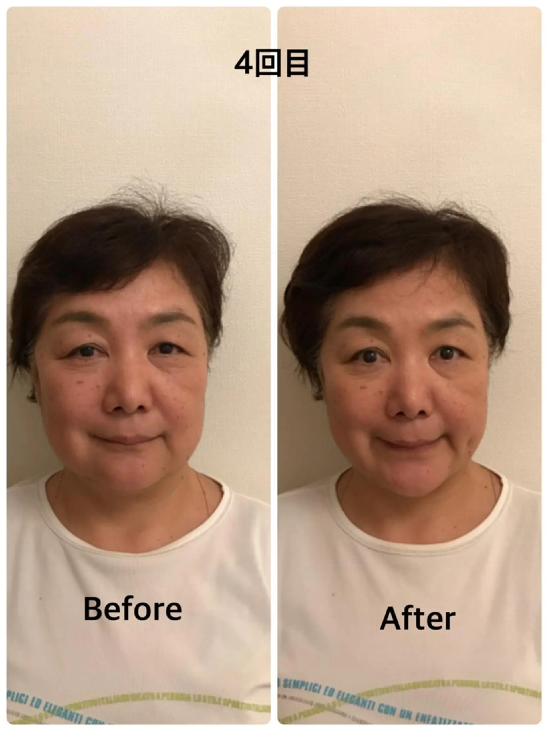 町田・鶴川 小顔矯正 /鈴木友実のその他イメージ