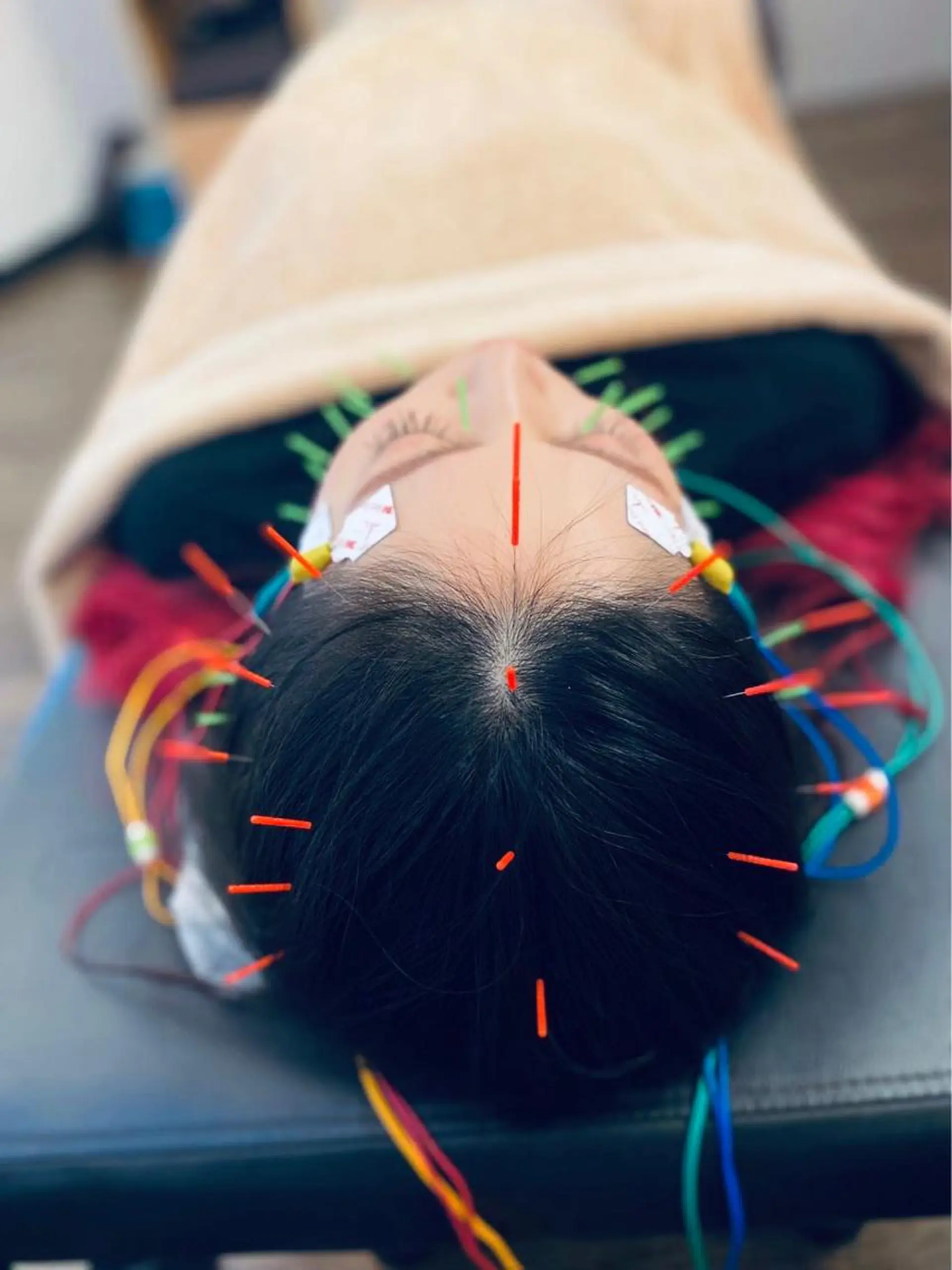 リラク はりきゅう    SieL所属・内田 有紀のエステ・リラクイメージ