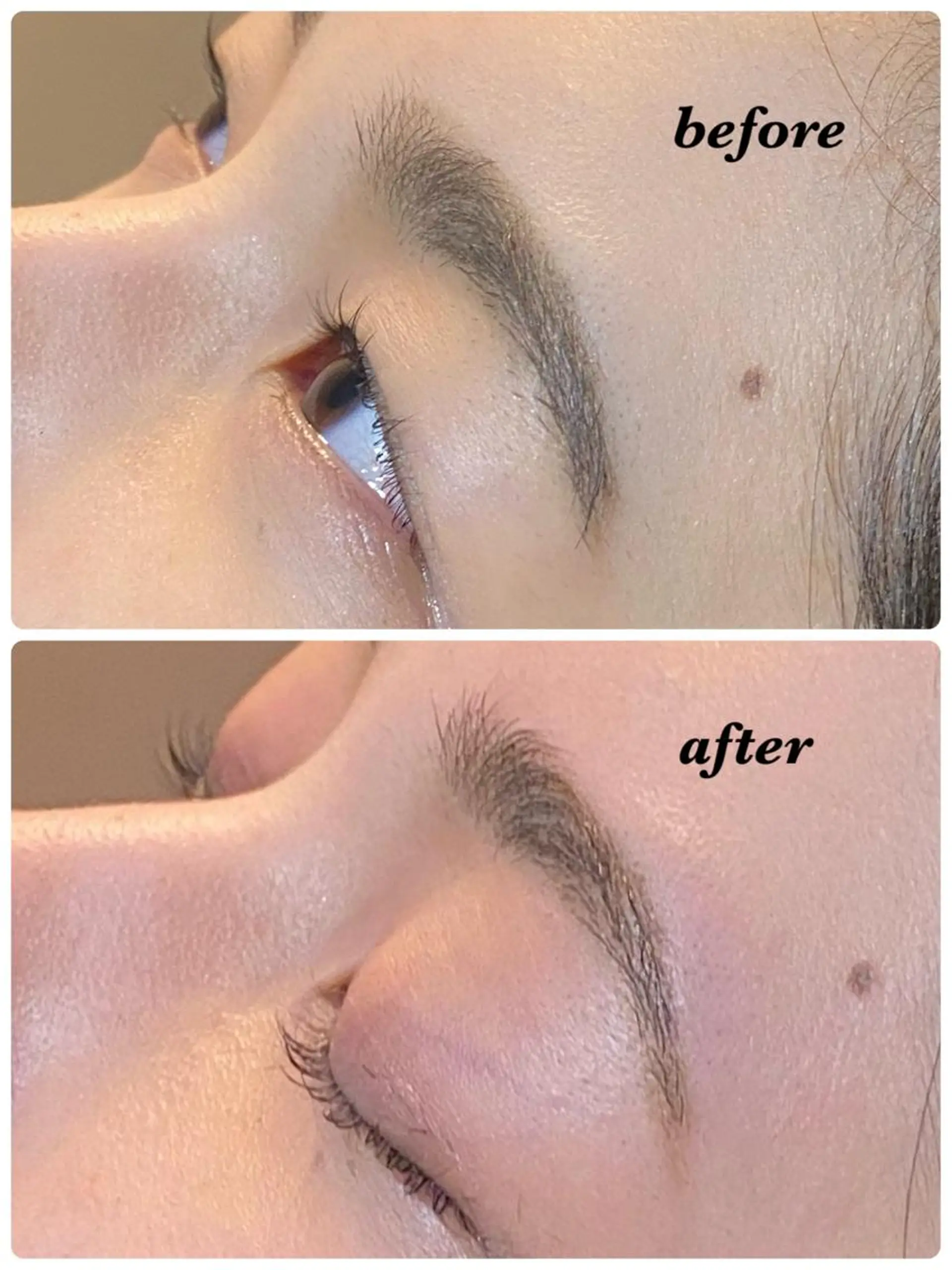 アイブロウ ハーブピーリング/韓国肌管理/フェイシャル/毛穴洗浄/眉毛/顔脱毛【糸脱毛専門】rev所属・ハーブピーリング🌹 毛穴洗浄❤️眉waxのエステ・リラクイメージ