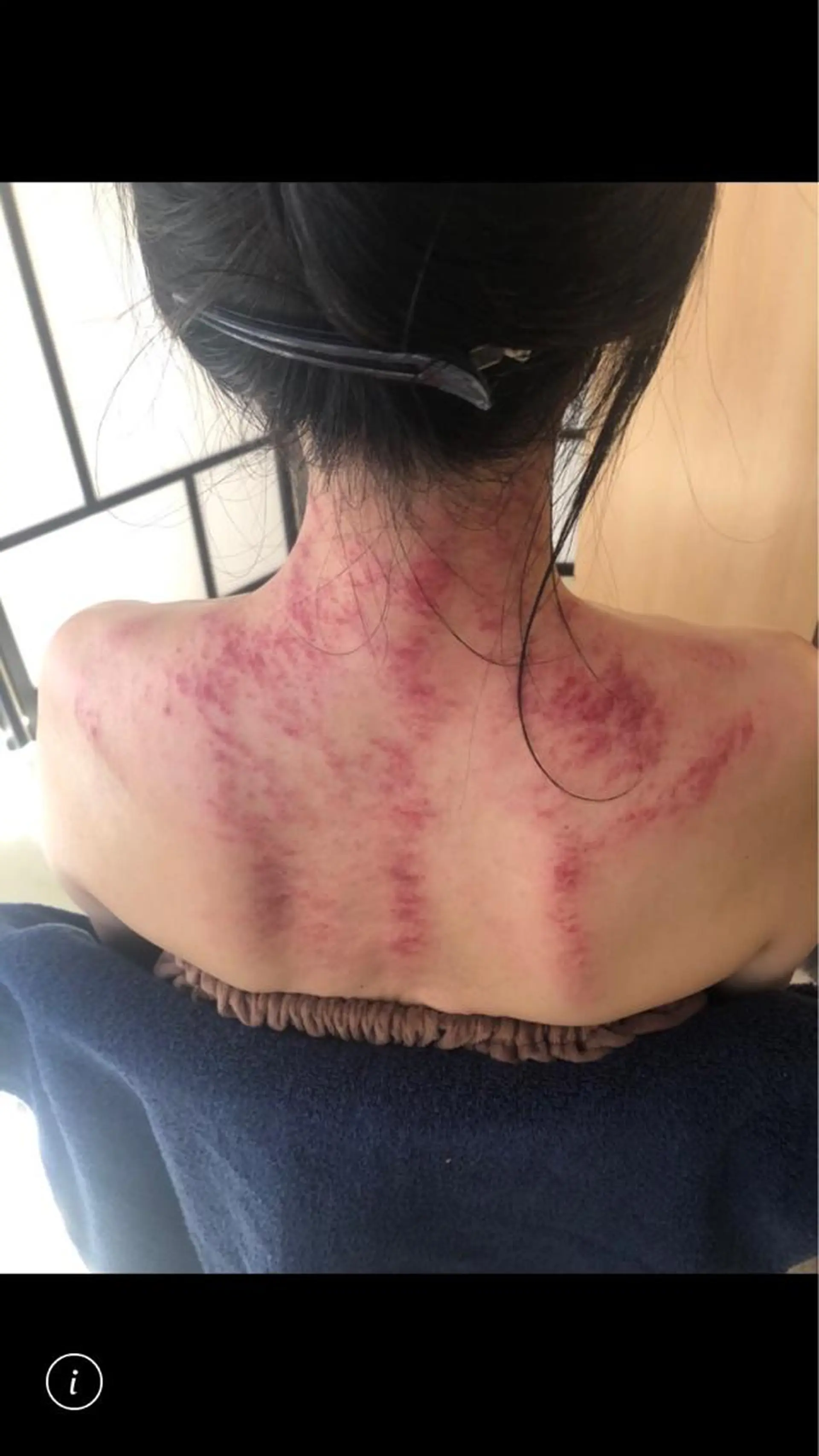 女性専用かっさサロン gloriefille所属・女性専用かっさサロン glorieのエステ・リラクイメージ