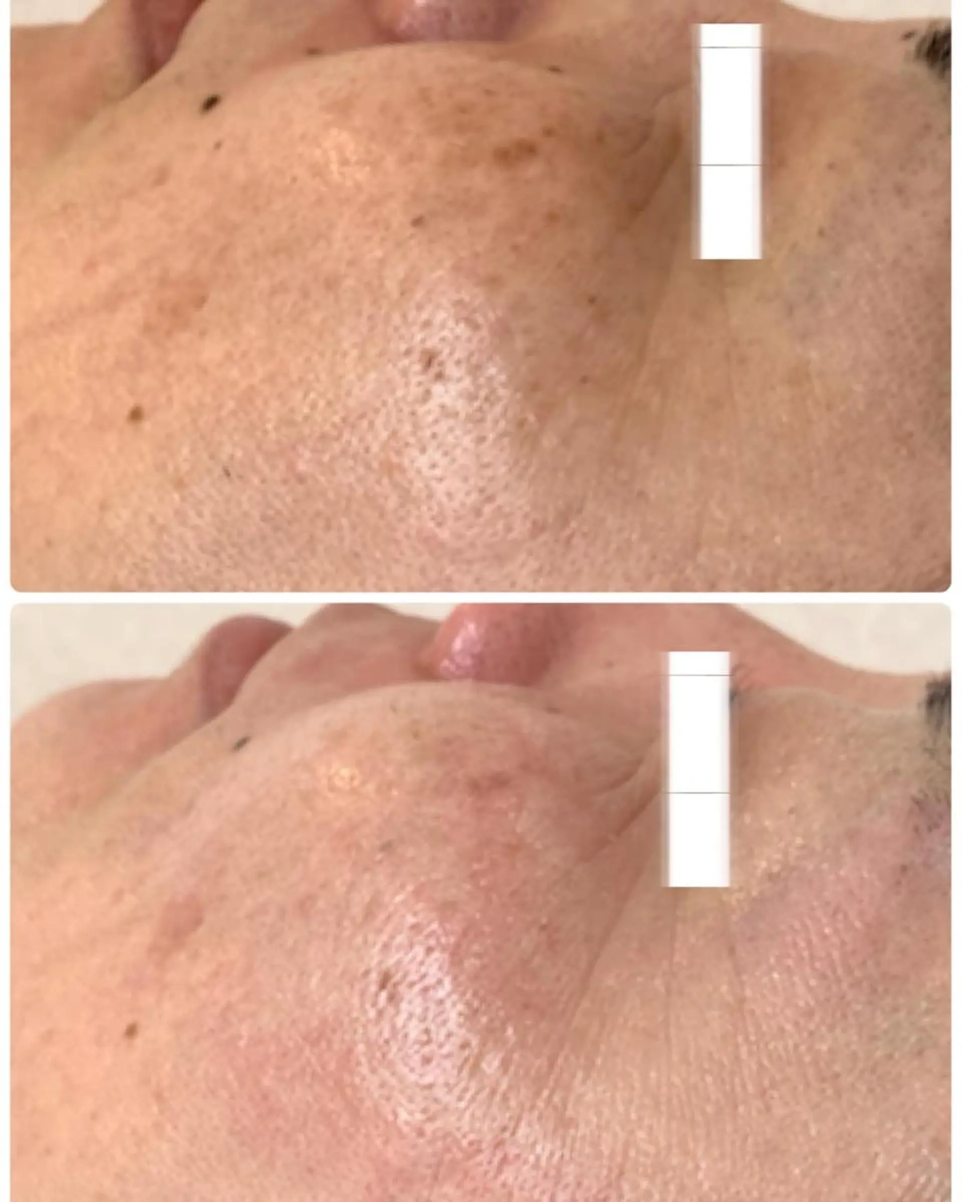 堀井 舞琳のエステ・リラクイメージ