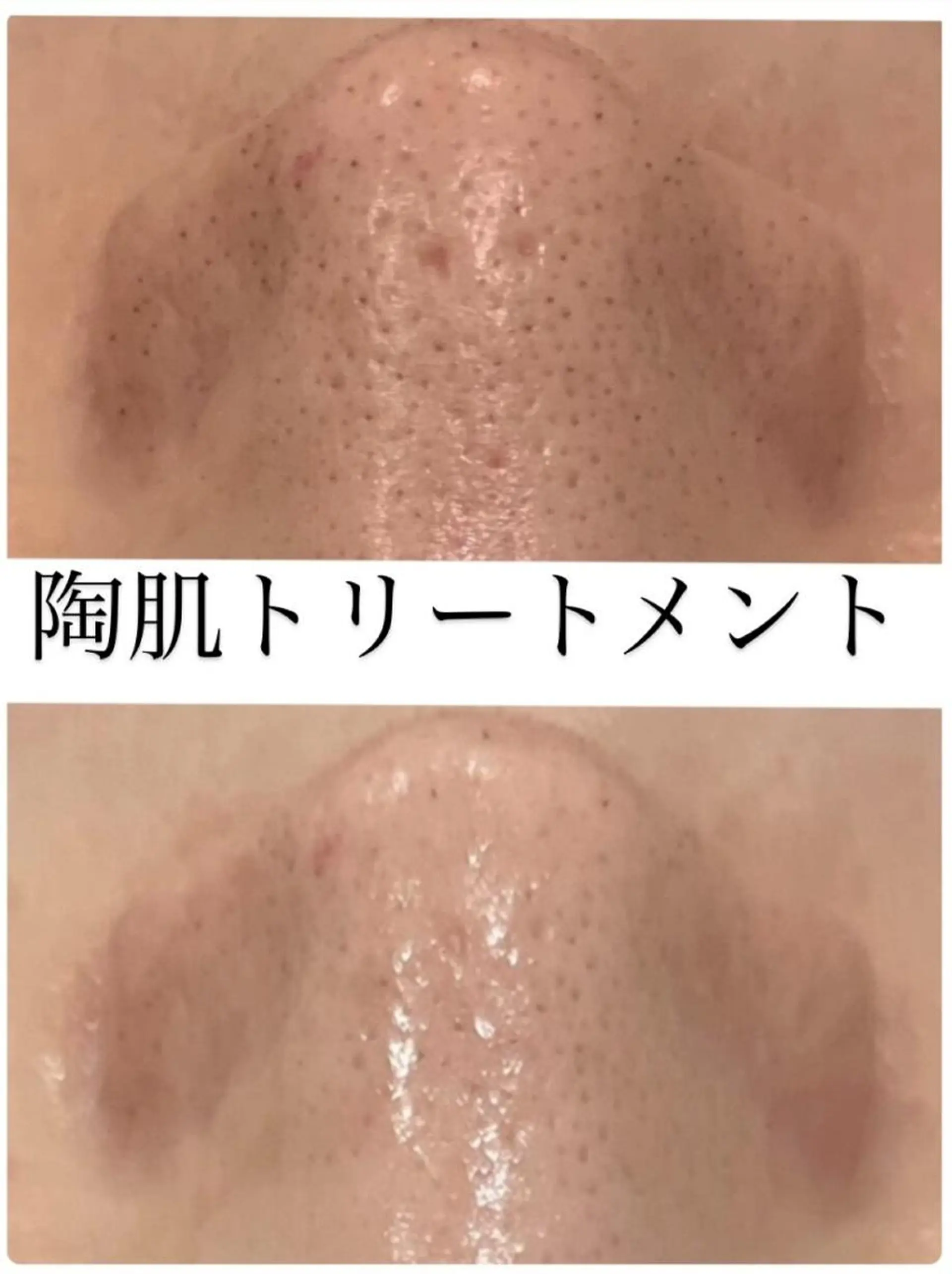 エステ リラク 立体小顔×艶肌×美ボ ディ似合わせ施術 岡のエステ・リラクイメージ