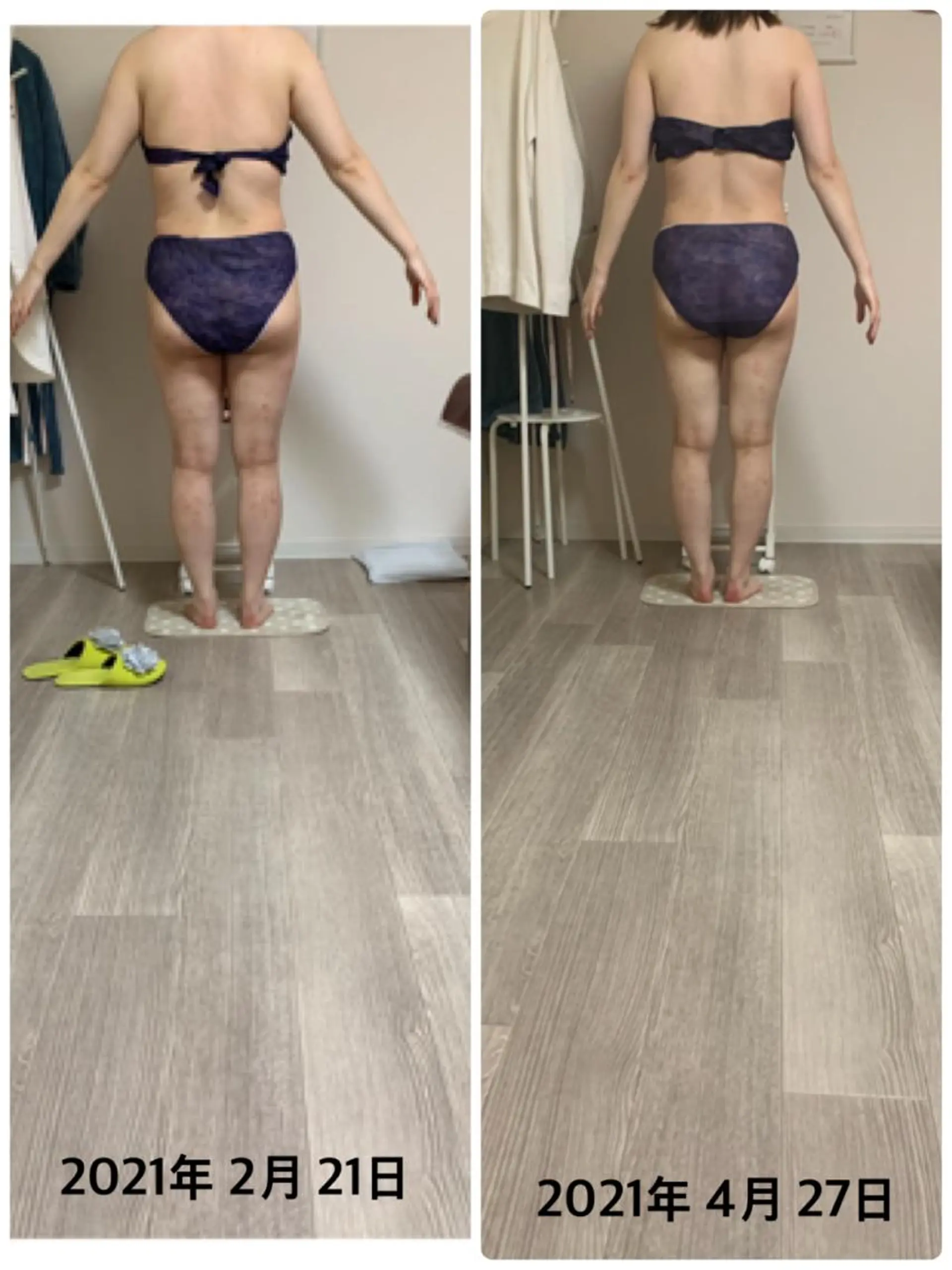 美ボディメイクサロン　only one body所属・所沢 痩身エステサロンのエステ・リラクイメージ