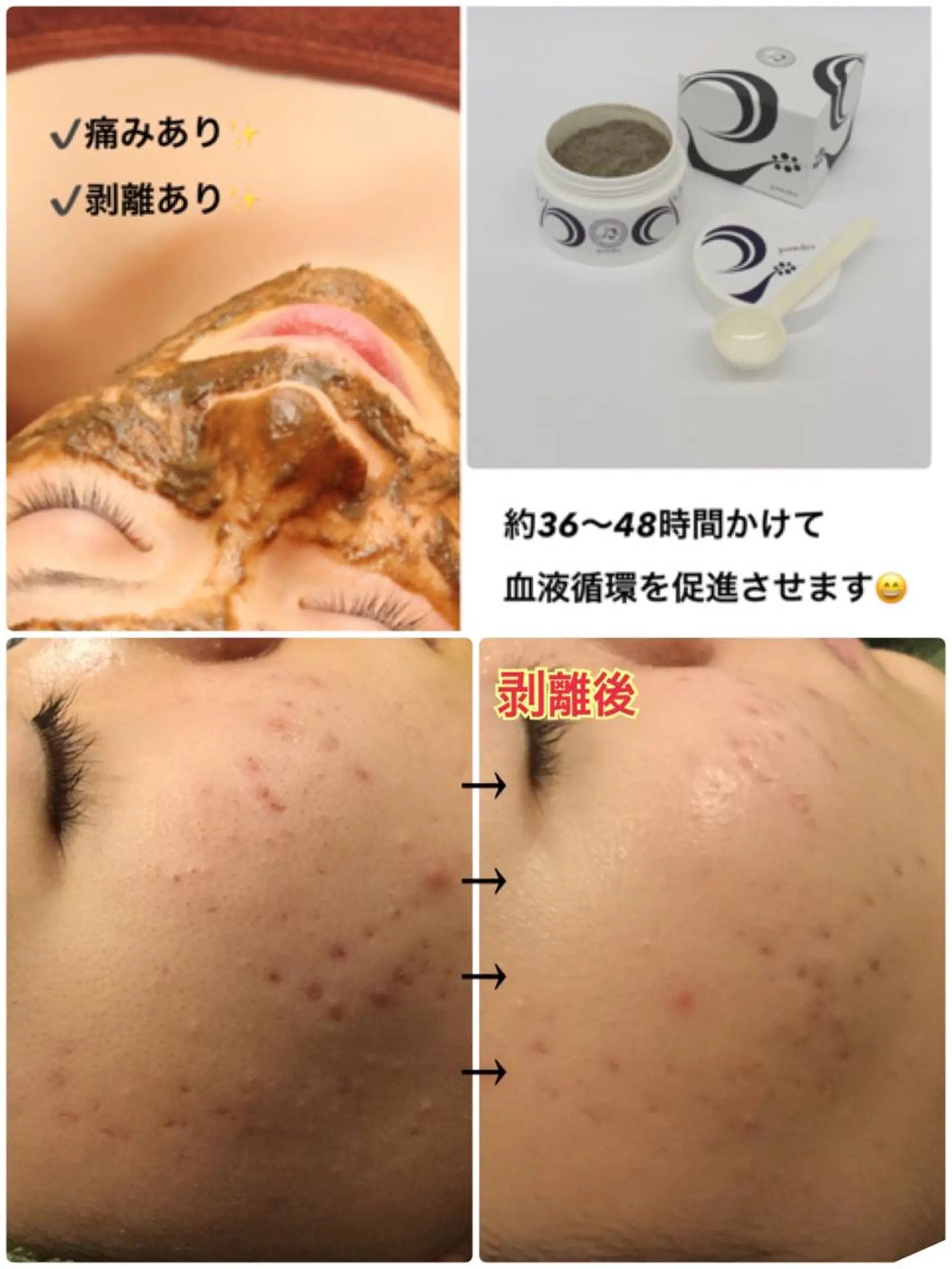 エステ 【リベルハーブピーリング認定店】敏感肌・美白脱毛専門店Dione立川店所属・Dione 立川店のエステ・リラクイメージ