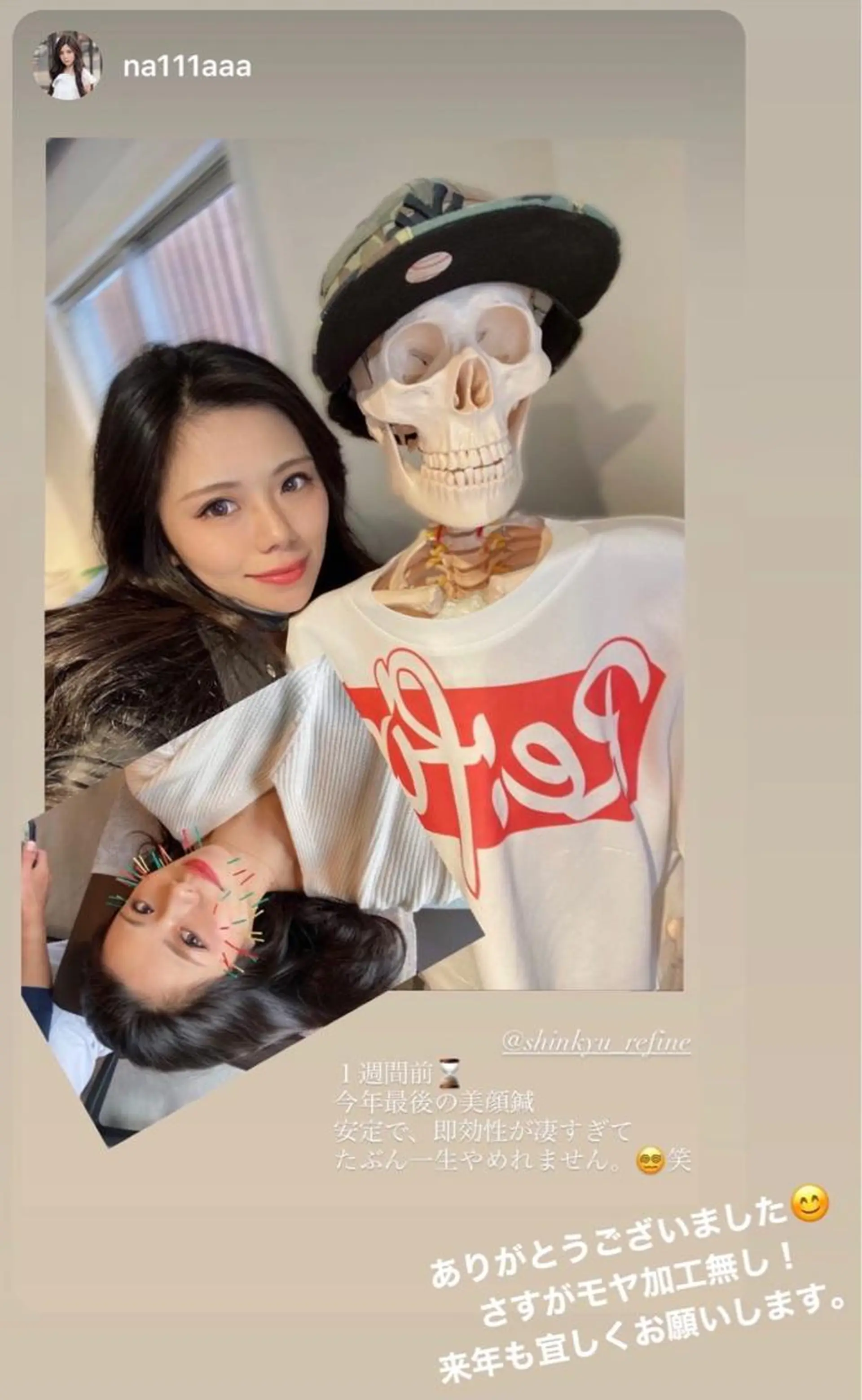 鍼灸整骨院Refine所属・鍼灸 Refineのその他イメージ