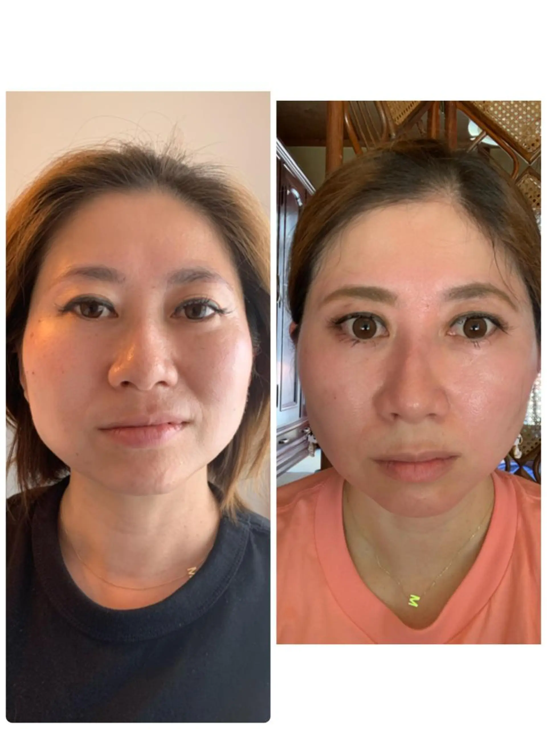 エステ Nail salon Three R所属・ネイルサロン Three   R.のエステ・リラクイメージ