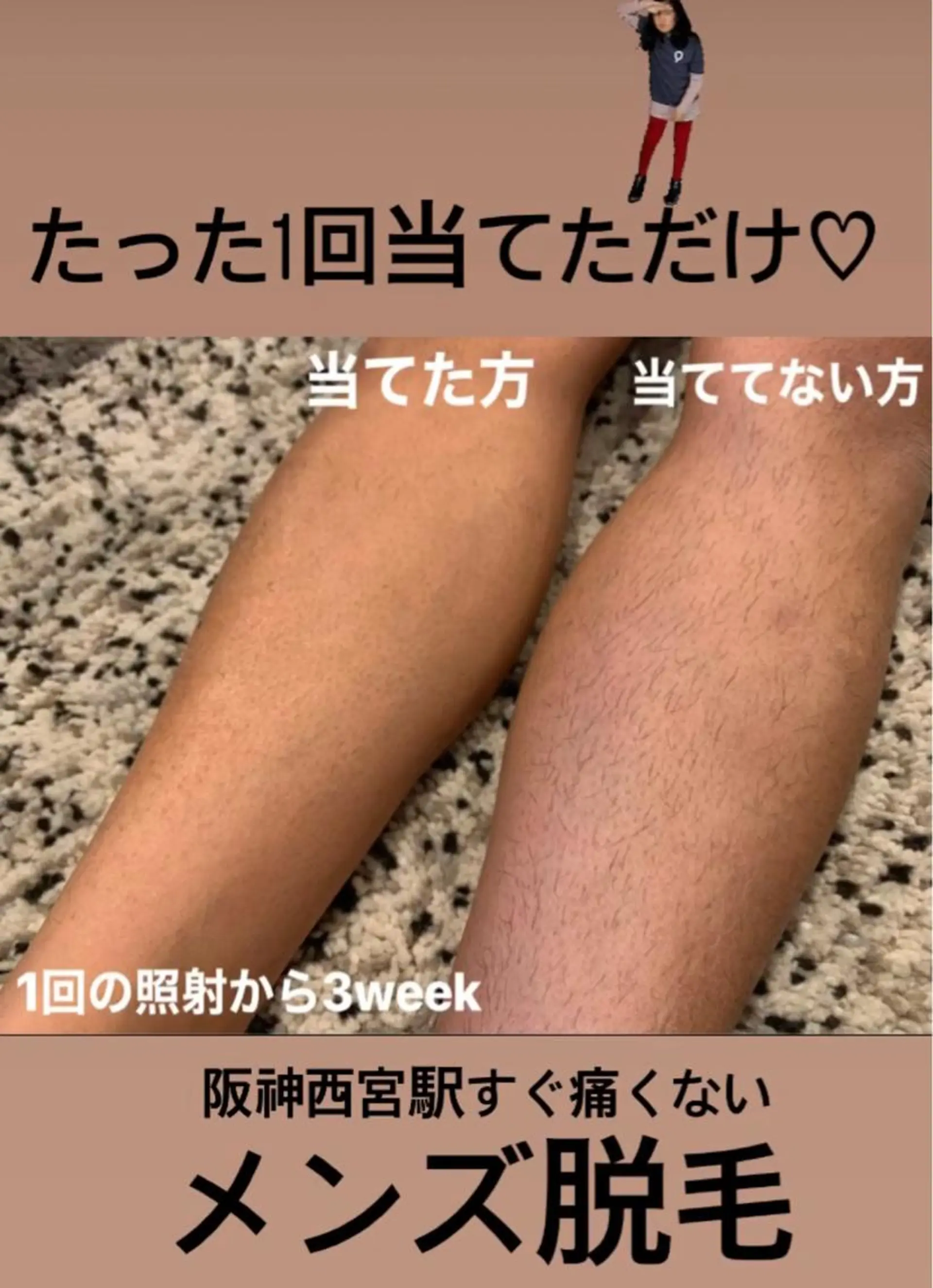 メンズ 脱毛＆エステサロン【アンリミット】所属・森谷 莉美のエステ・リラクイメージ