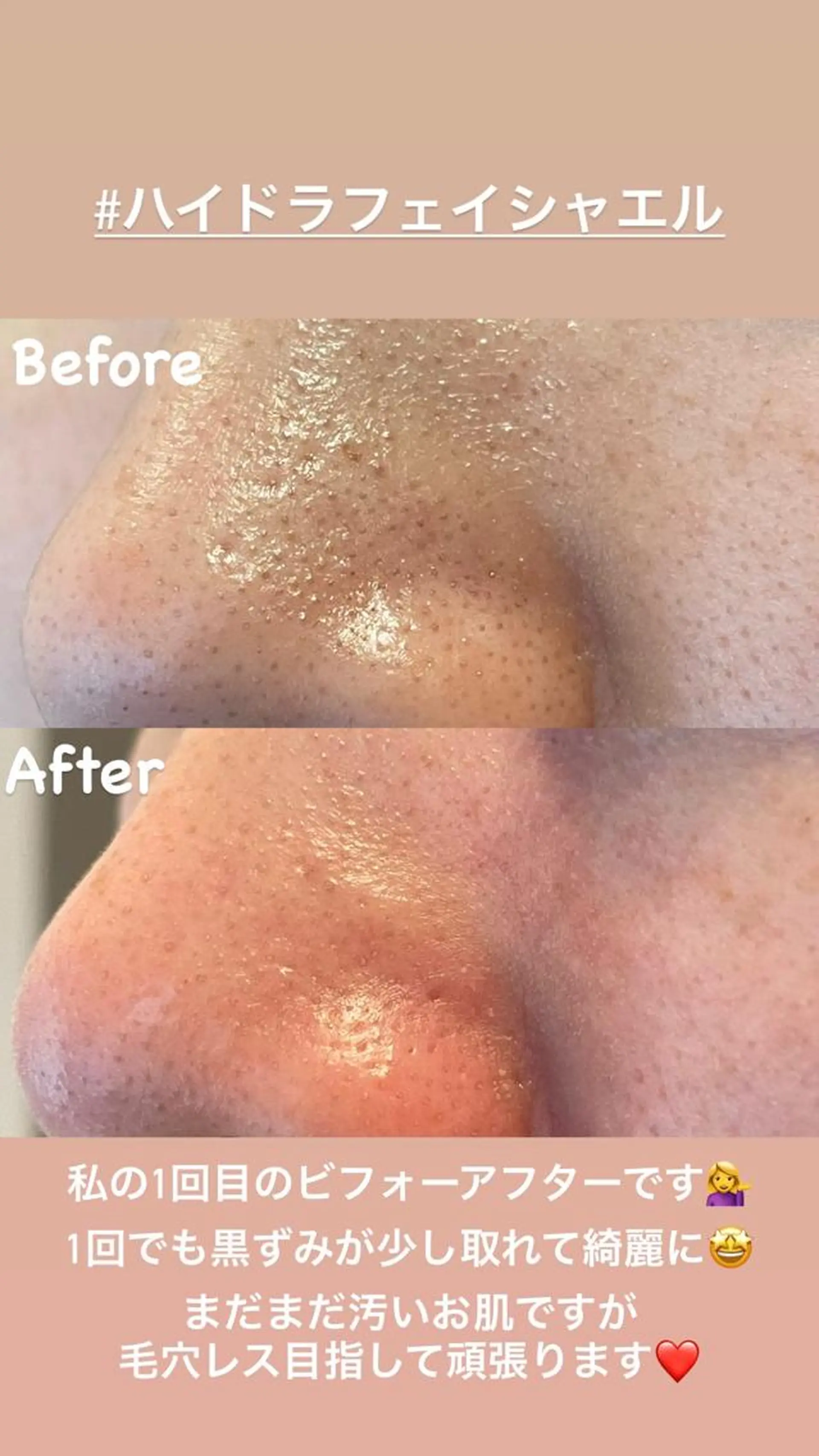 エステ nakao toshimiのエステ・リラクイメージ