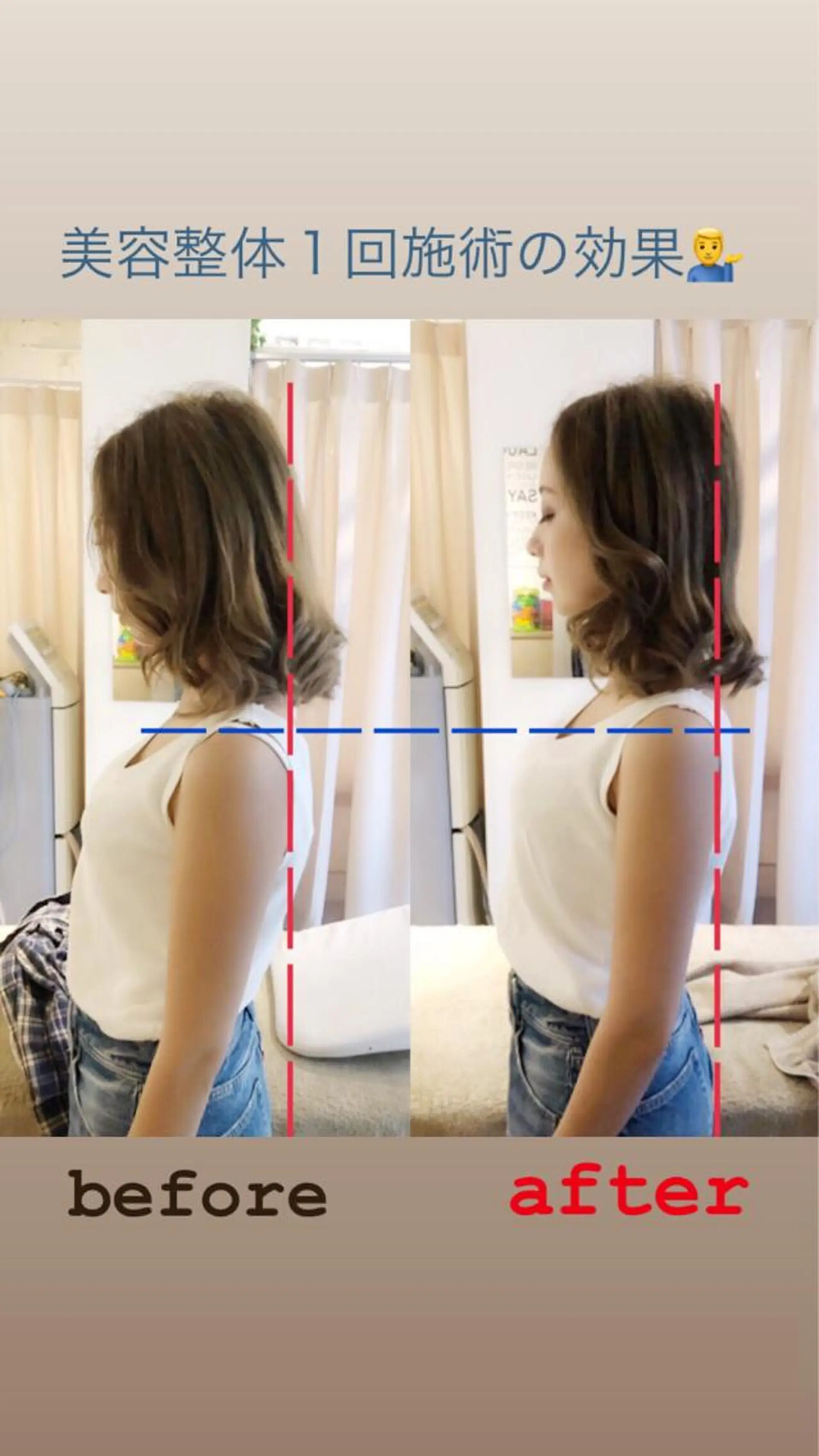 鍼灸整骨院Refine所属・鍼灸 Refineのその他イメージ