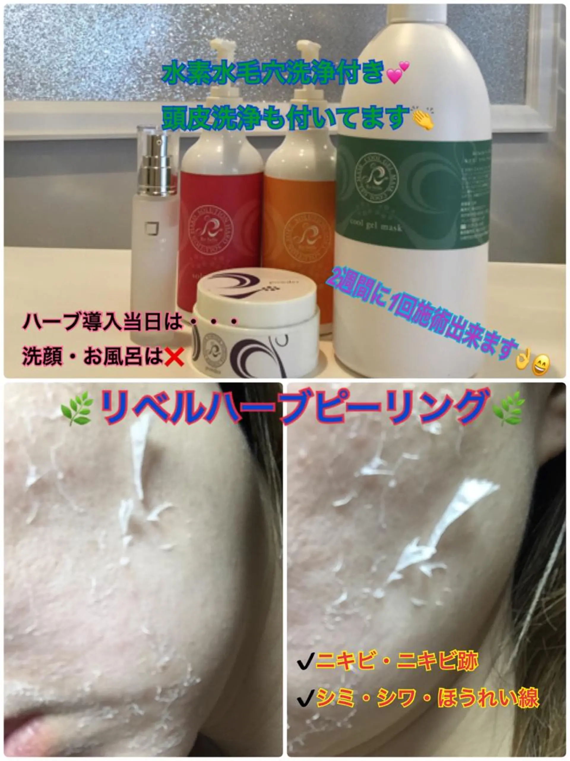 エステ 【リベルハーブピーリング認定店】敏感肌・美白脱毛専門店Dione立川店所属・Dione 立川店のエステ・リラクイメージ