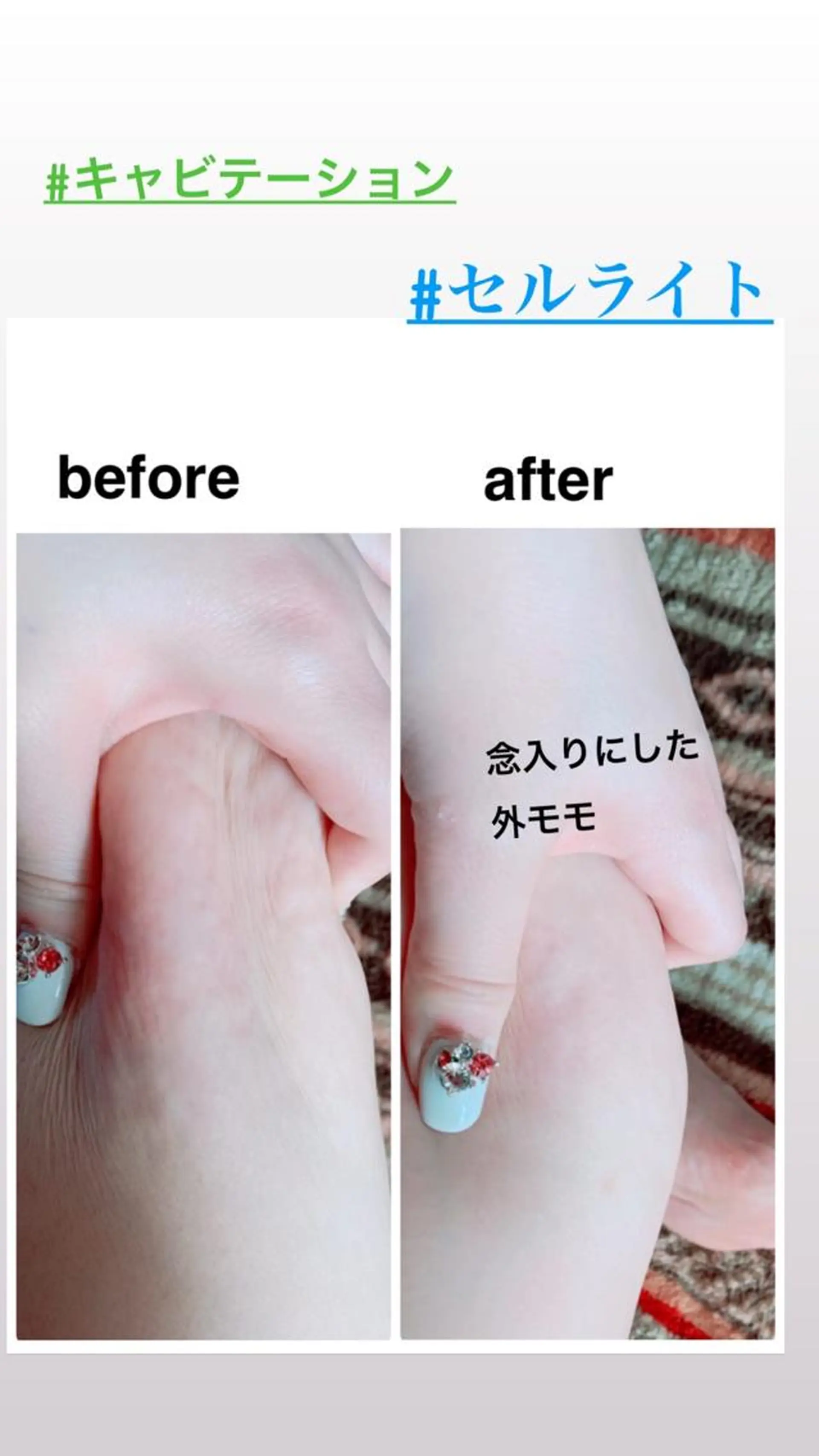 エステ リラク 痩身/脱毛/ネイル HARUKAのエステ・リラクイメージ