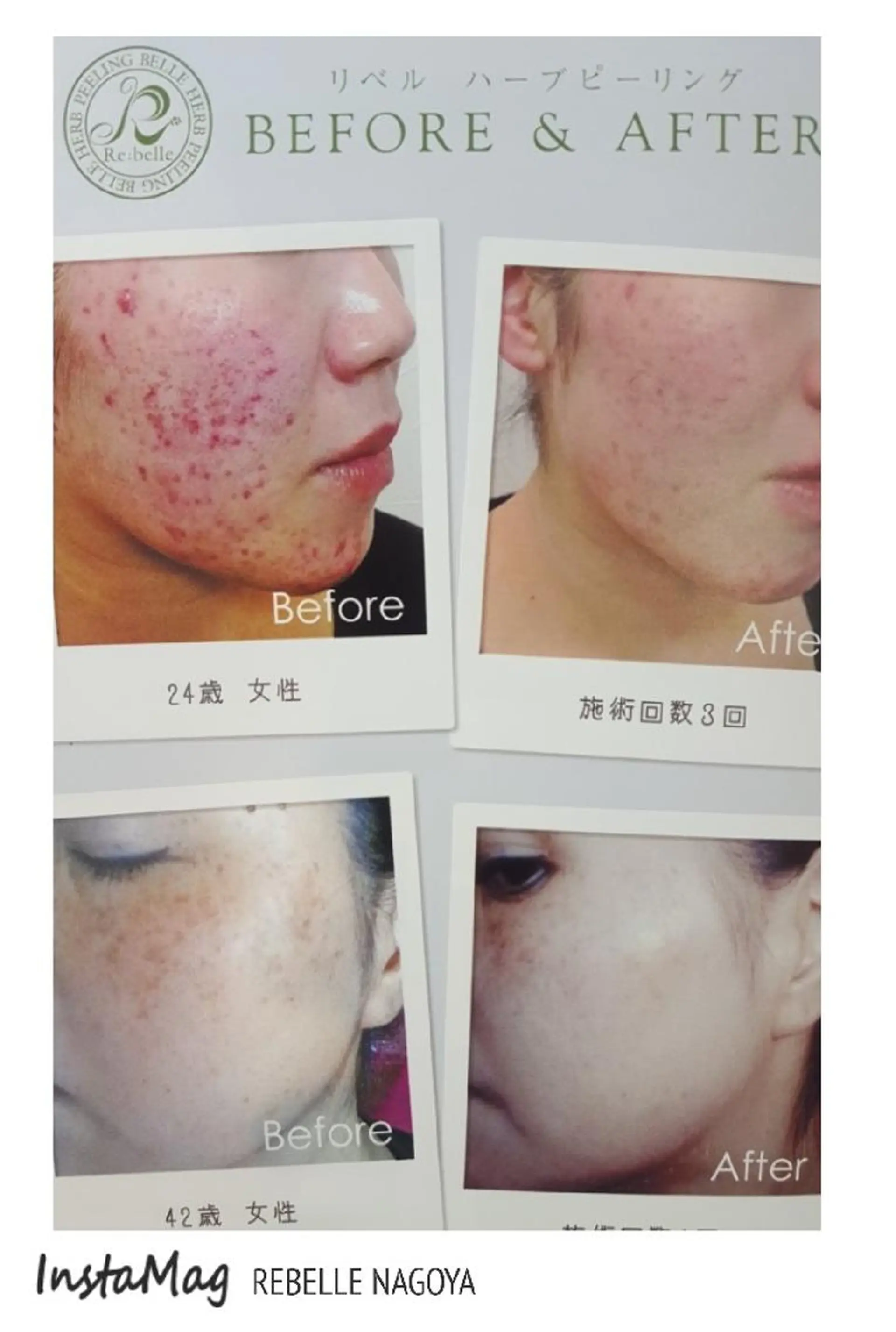 パーマ ネイル マツエク・マツパ ヘアアレンジ ミディアム カラー 次世代まつげパーマは 『リベル名古屋』のマツエク・マツパデザイン