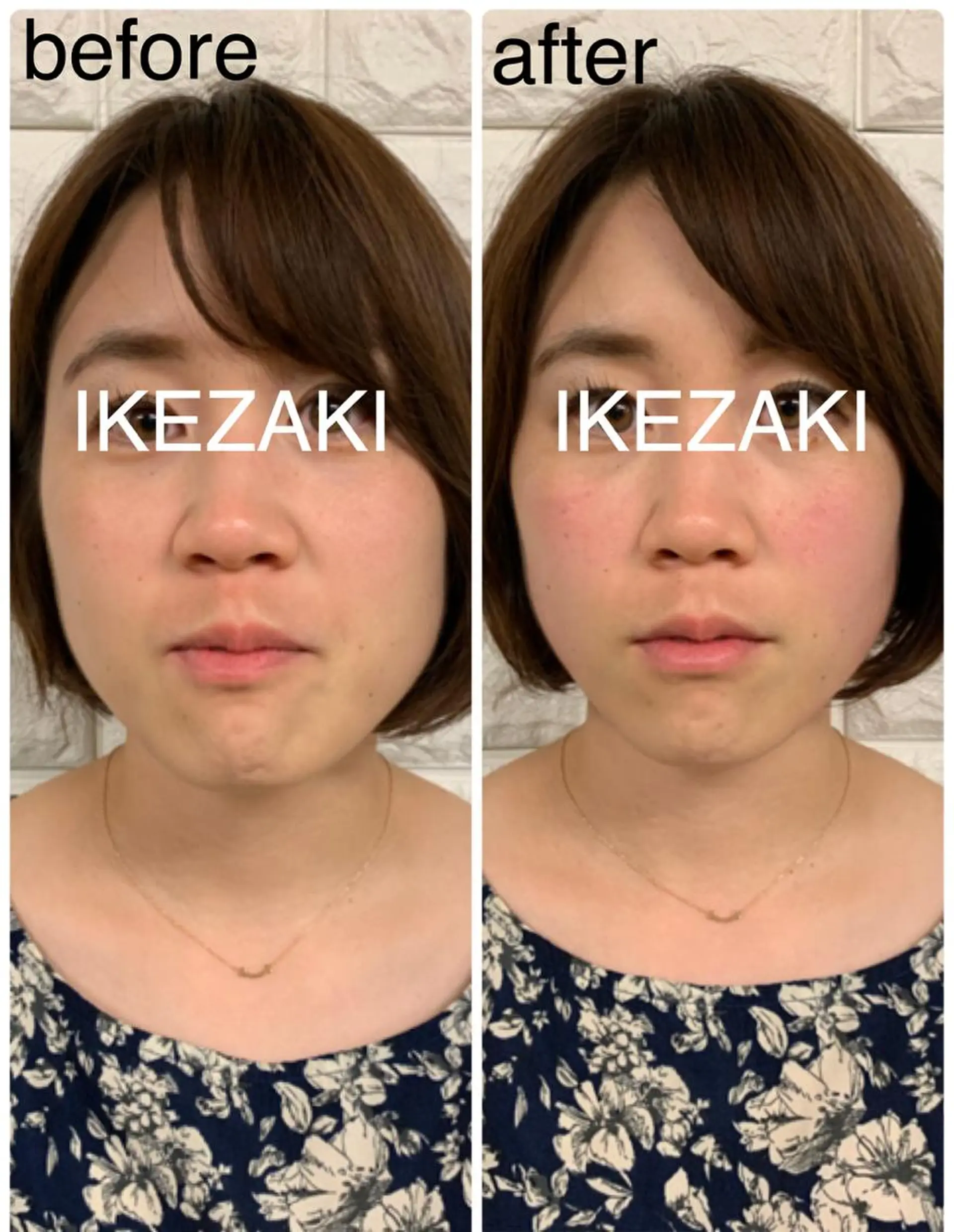 美容鍼 IKEZAKIのエステ・リラクイメージ