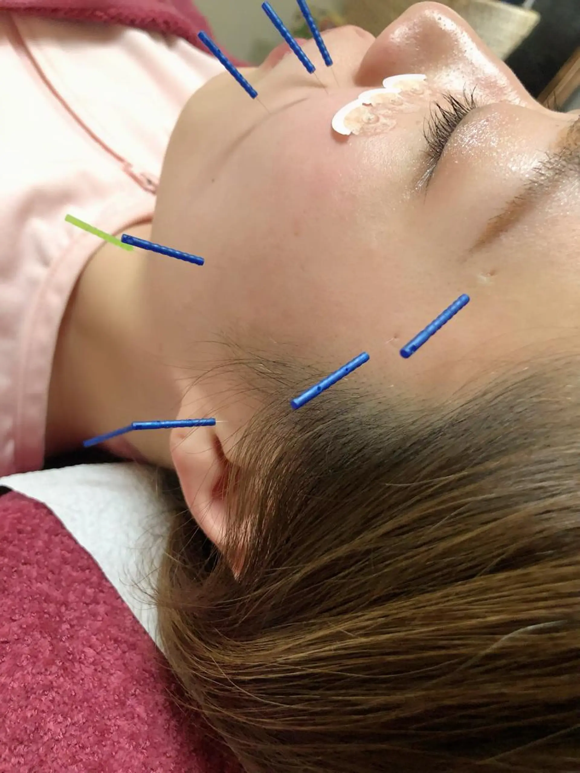 美容鍼灸女性専用 りんご鍼灸治療院のエステ・リラクイメージ