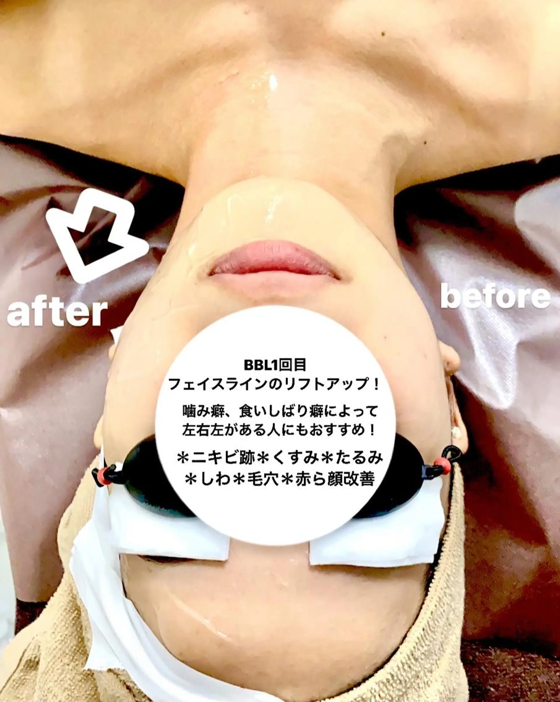 脱毛 Epina 千葉店 【エピナ】のエステ・リラクイメージ