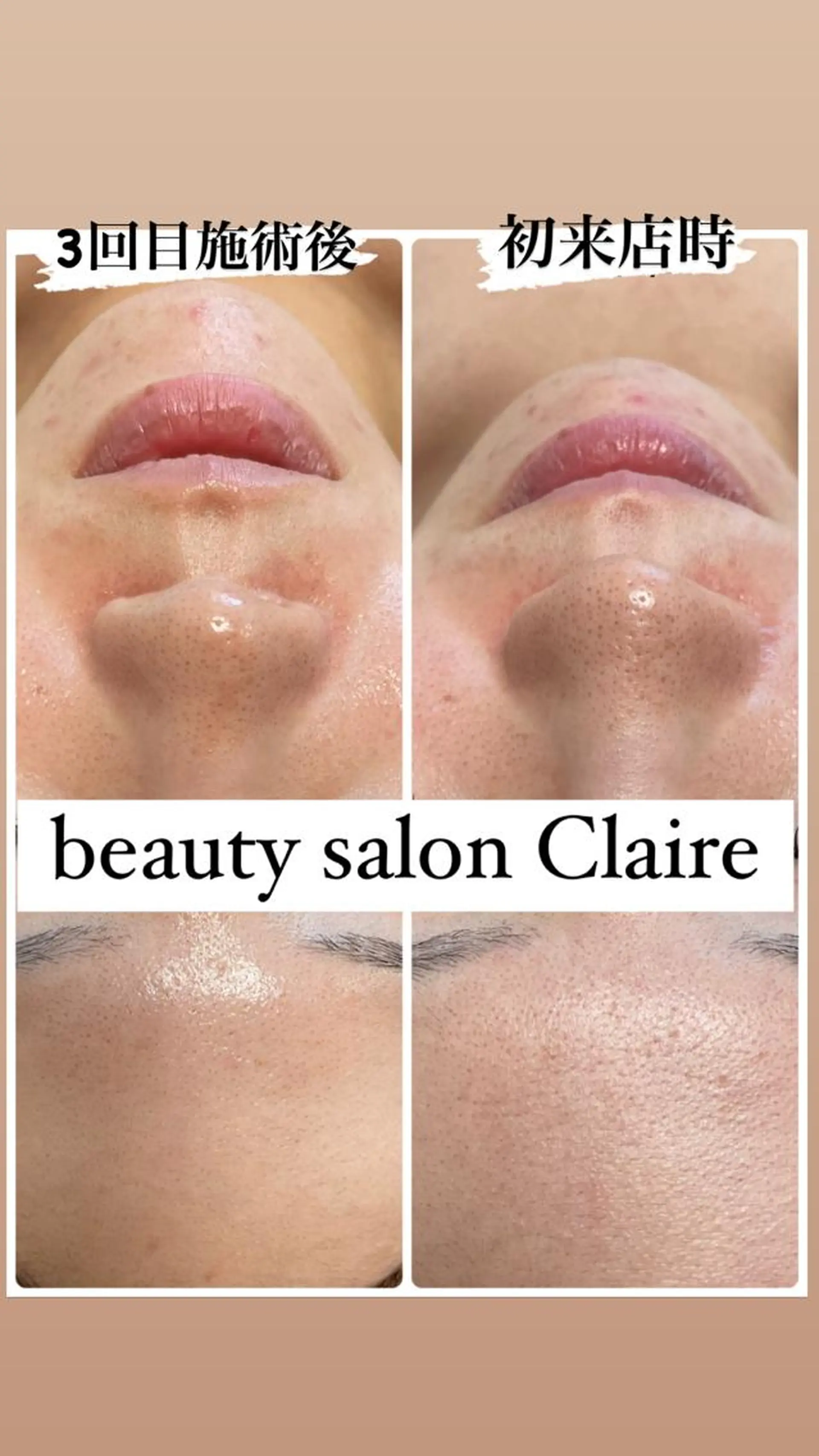 エステ リラク ビューティーサロン Claireのエステ・リラクイメージ