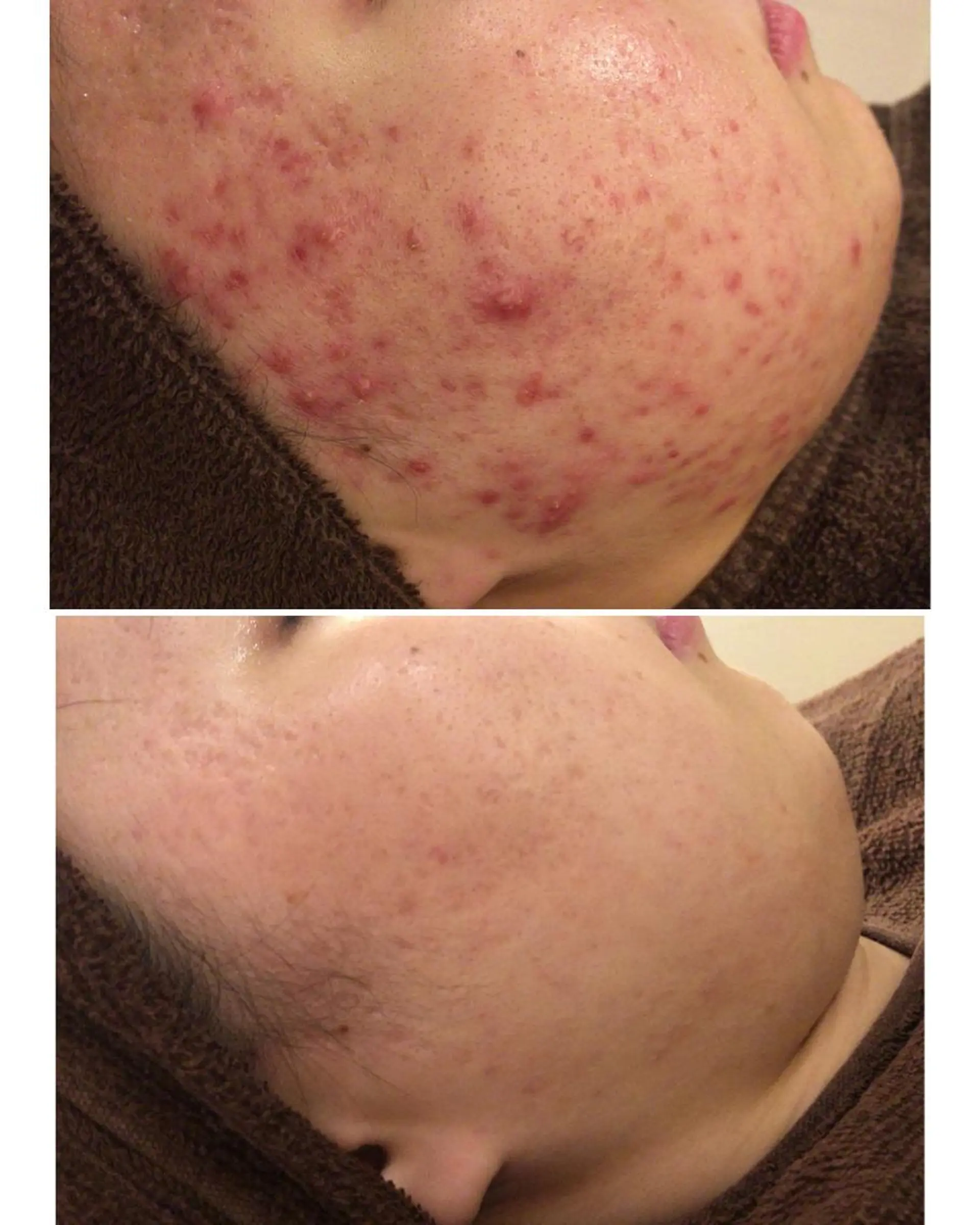 ミディアム カラー パーマ ヘアアレンジ メンズ キッズ ネイル マツエク・マツパ ニキビ・肌質改善専門 ♡人生が変わるサロンのエステ・リラクイメージ