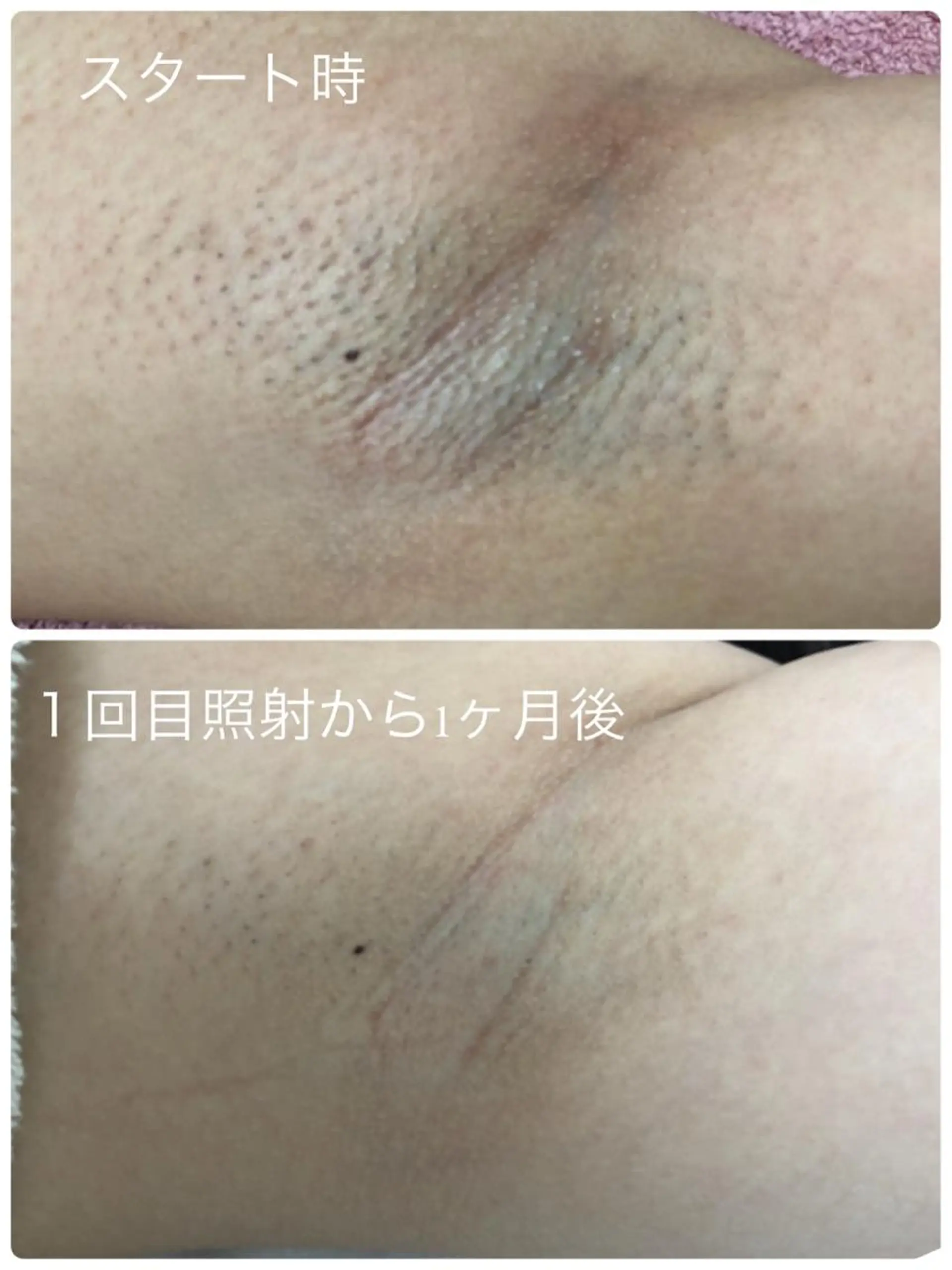 小顔と腸の専門店 ラクーラビューティのエステ・リラクイメージ