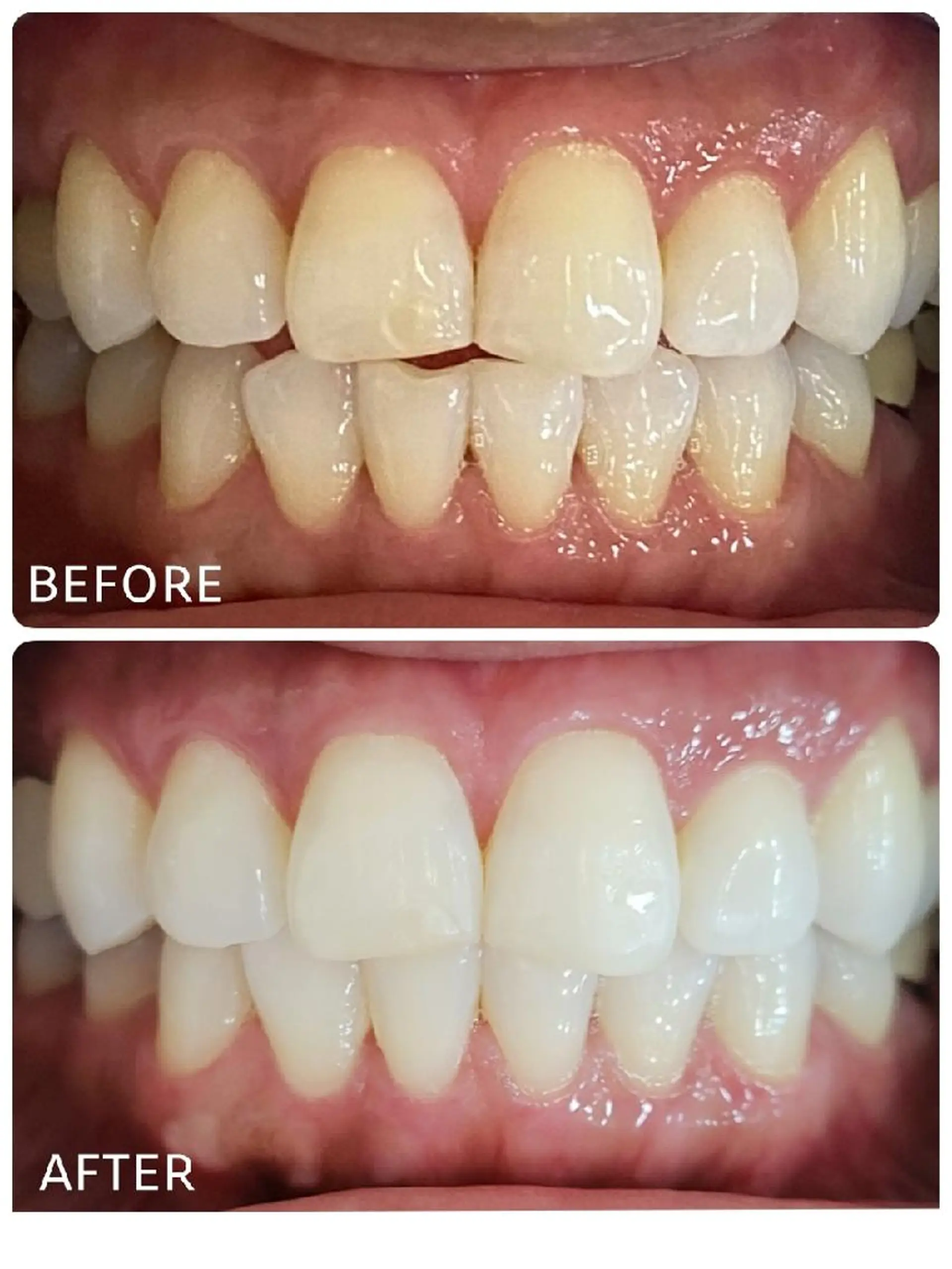 ホワイトニングサロン ラウレアのその他イメージ