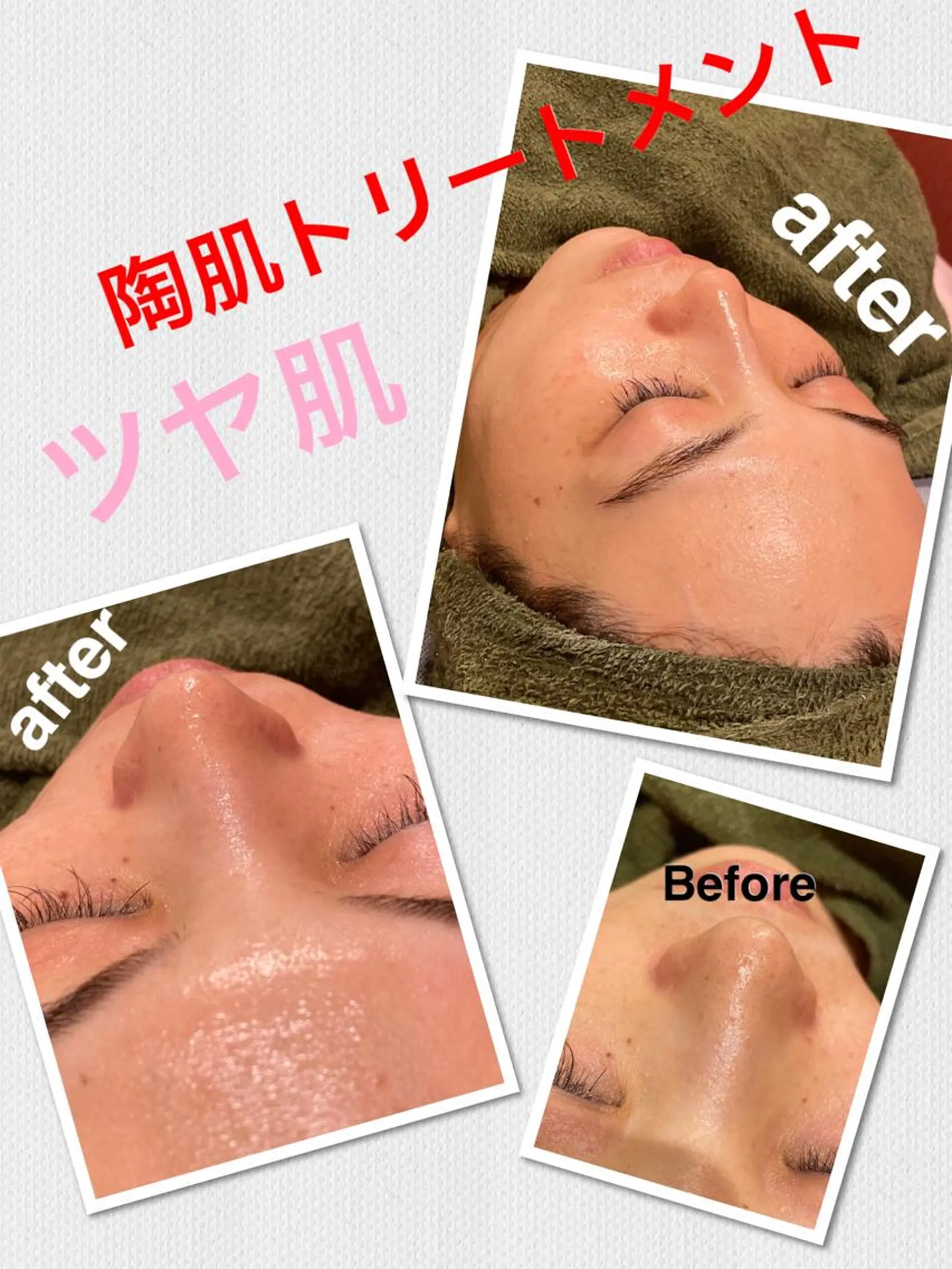 エステ 【リベルハーブピーリング認定店】敏感肌・美白脱毛専門店Dione立川店所属・Dione 立川店のエステ・リラクイメージ