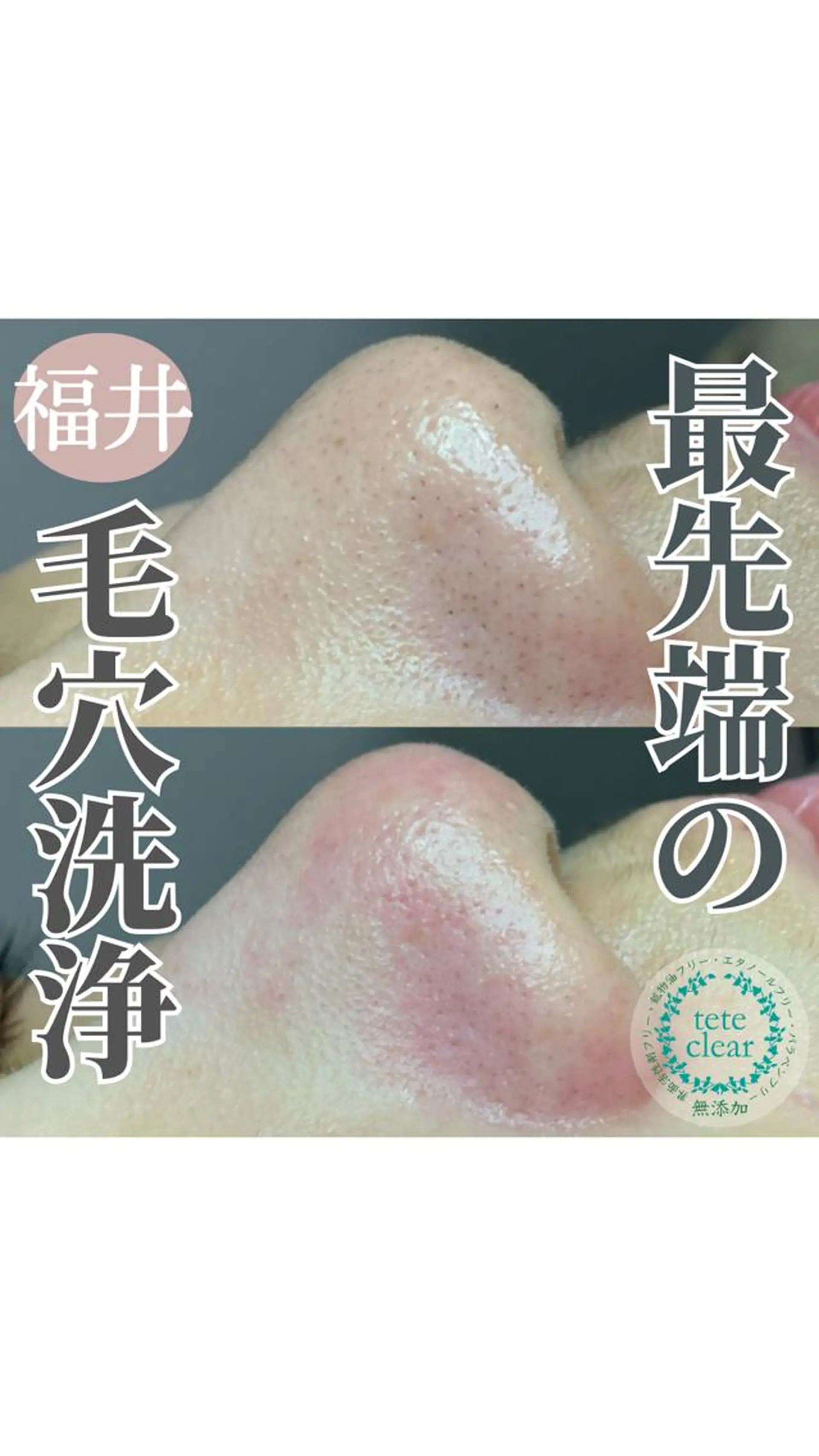 毛穴肌質ケアサロン Yourmeユアミーのエステ・リラクイメージ