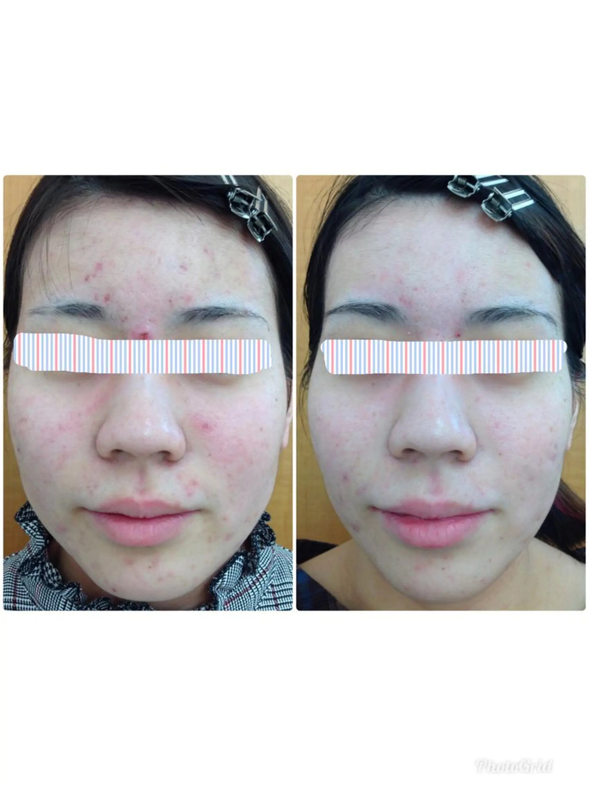 Facial stylist salon伊勢崎所属・中島 有希のエステ・リラクイメージ