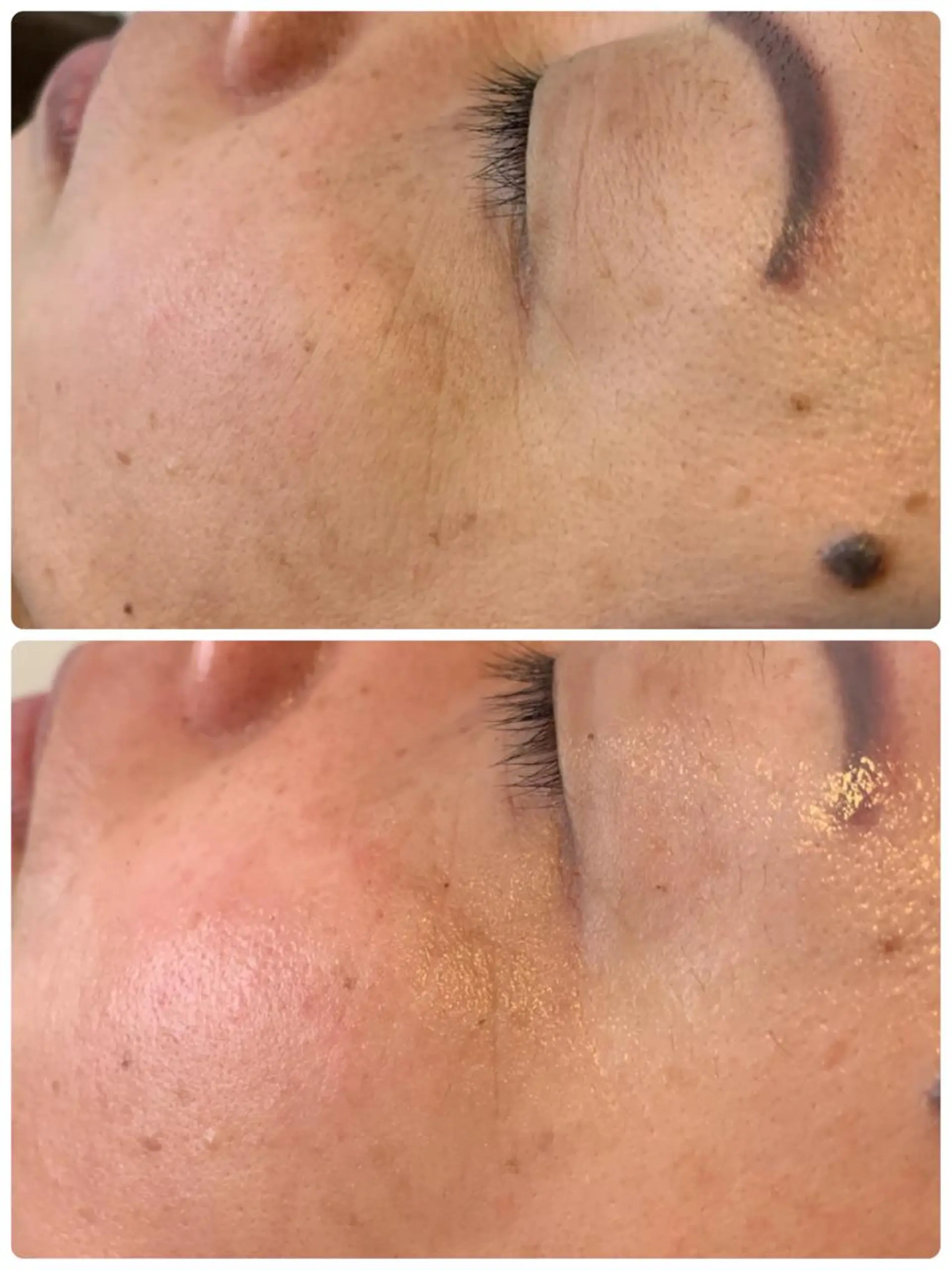 espoir エスポワールのネイルデザイン