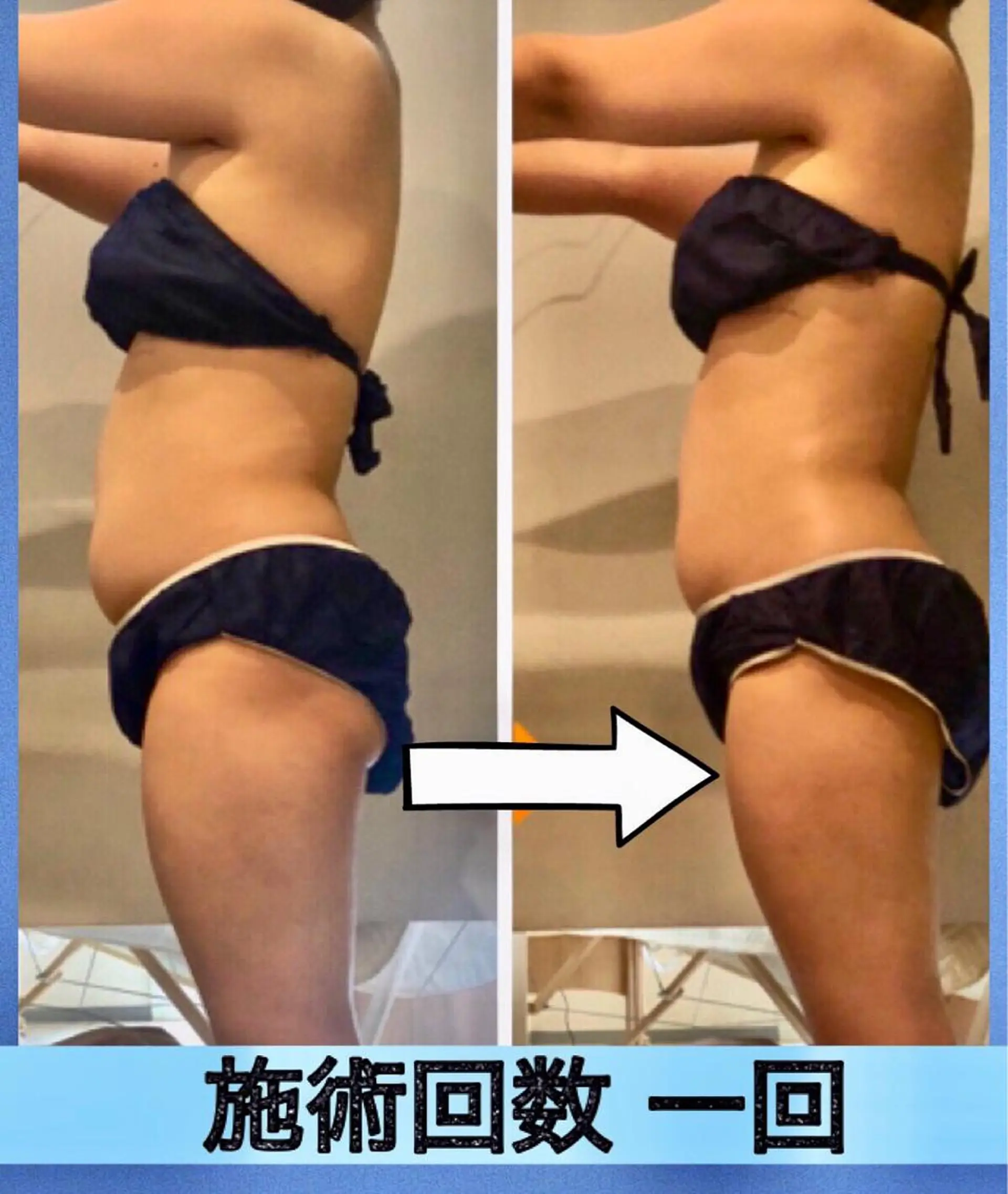 ロング カラー パーマ ヘアアレンジ メンズ キッズ ネイル マツエク・マツパ ‍痩身＆ボディ 結果出し🌟丹野のエステ・リラクイメージ