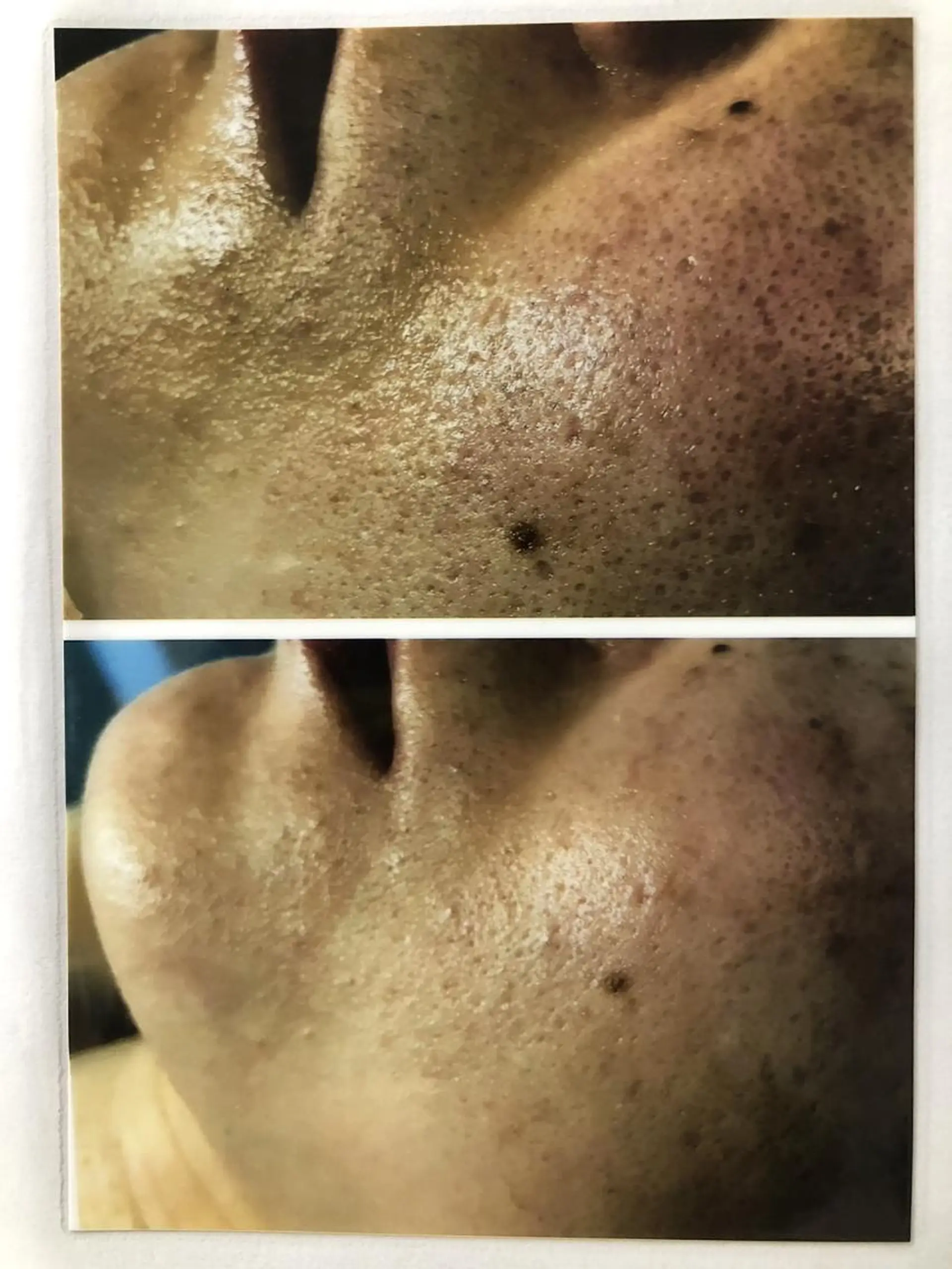 エステ Dione湘南藤沢店 ×LUANA　齋藤のエステ・リラクイメージ