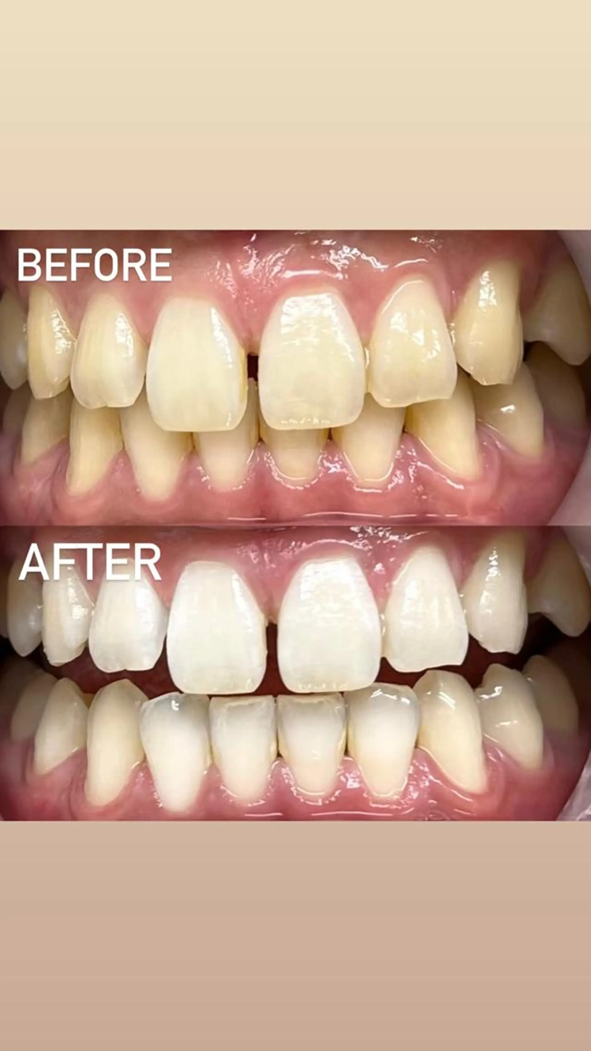 LBSホワイトニング 銀座店💎店長浦和のその他イメージ