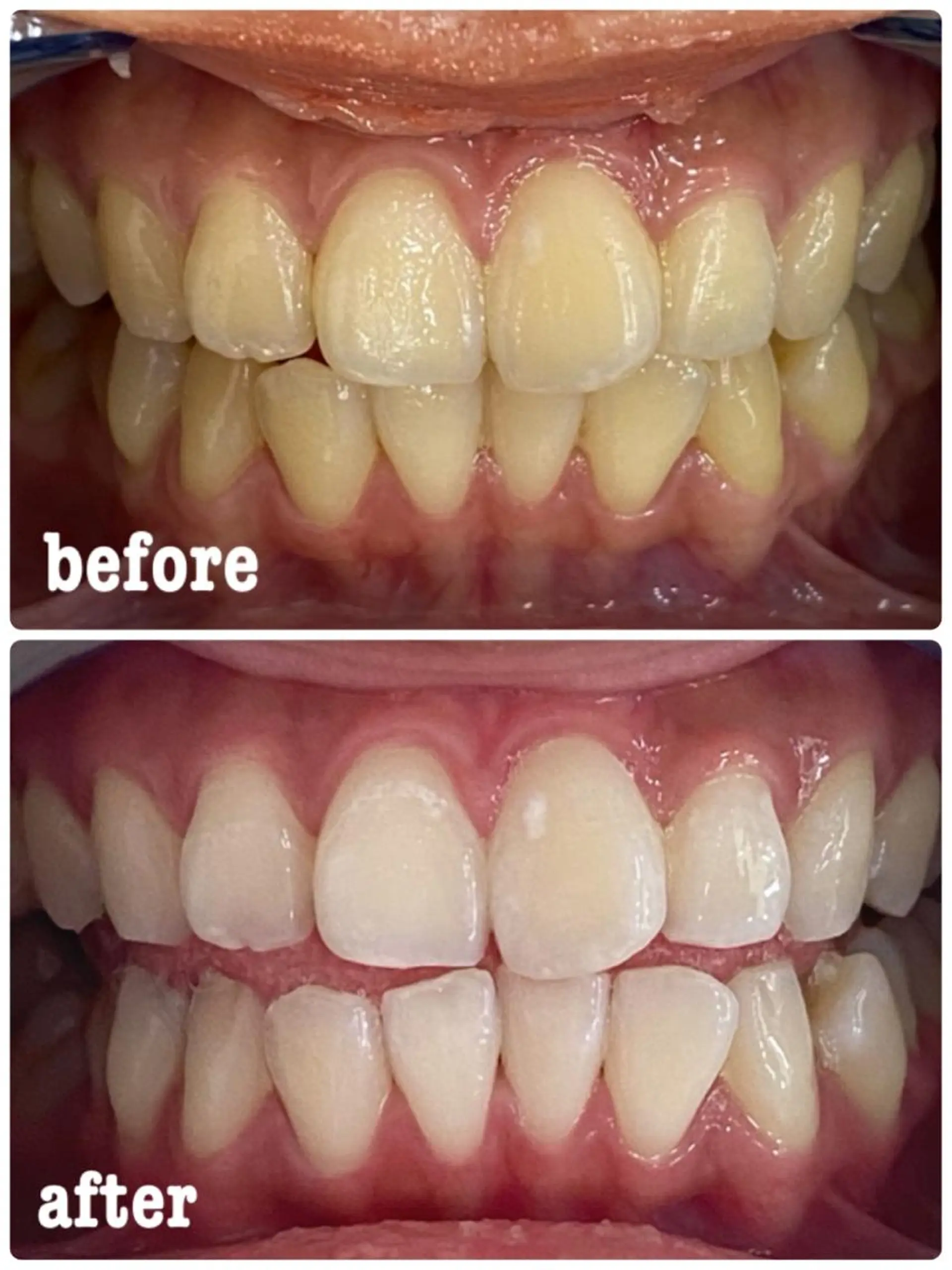 その他 ホワイトニングサロン ラウレアのその他イメージ