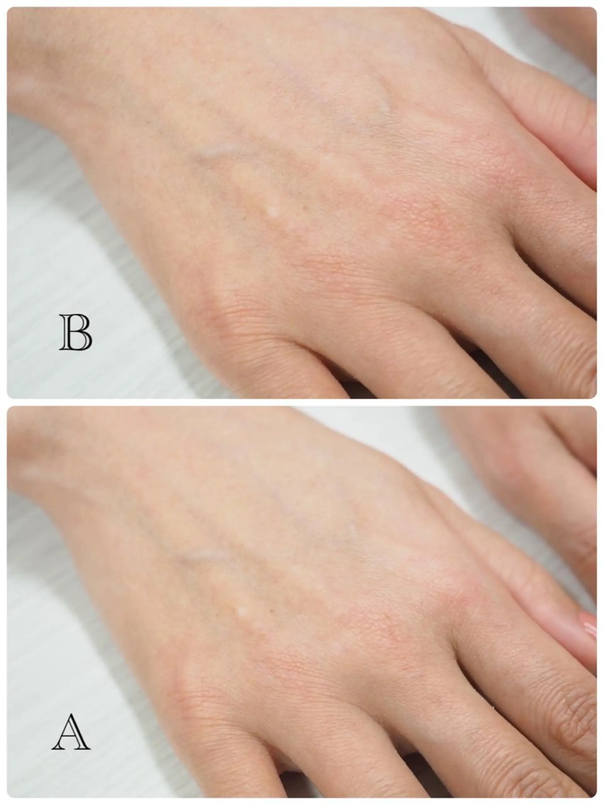 ネイル Nail Canvas Silva.所属・Silva MAIのネイルデザイン